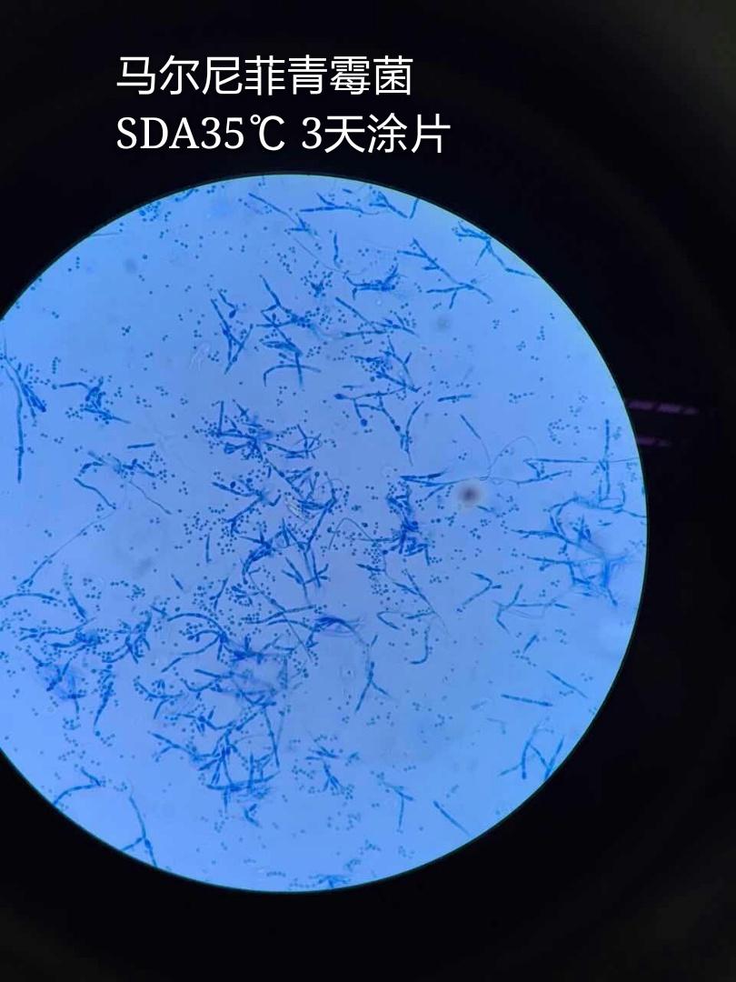 青霉菌光学显微镜图片图片