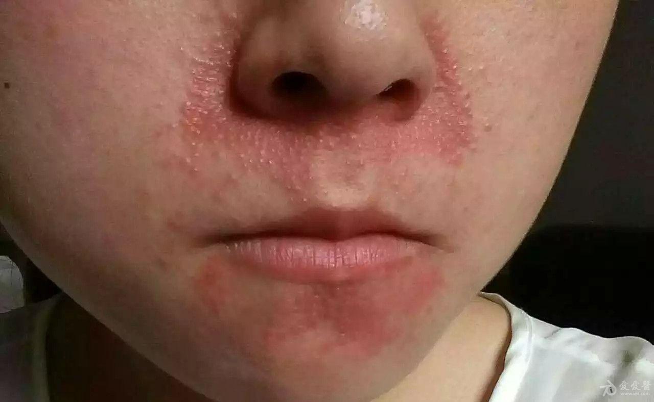 病例讨论看图诊病