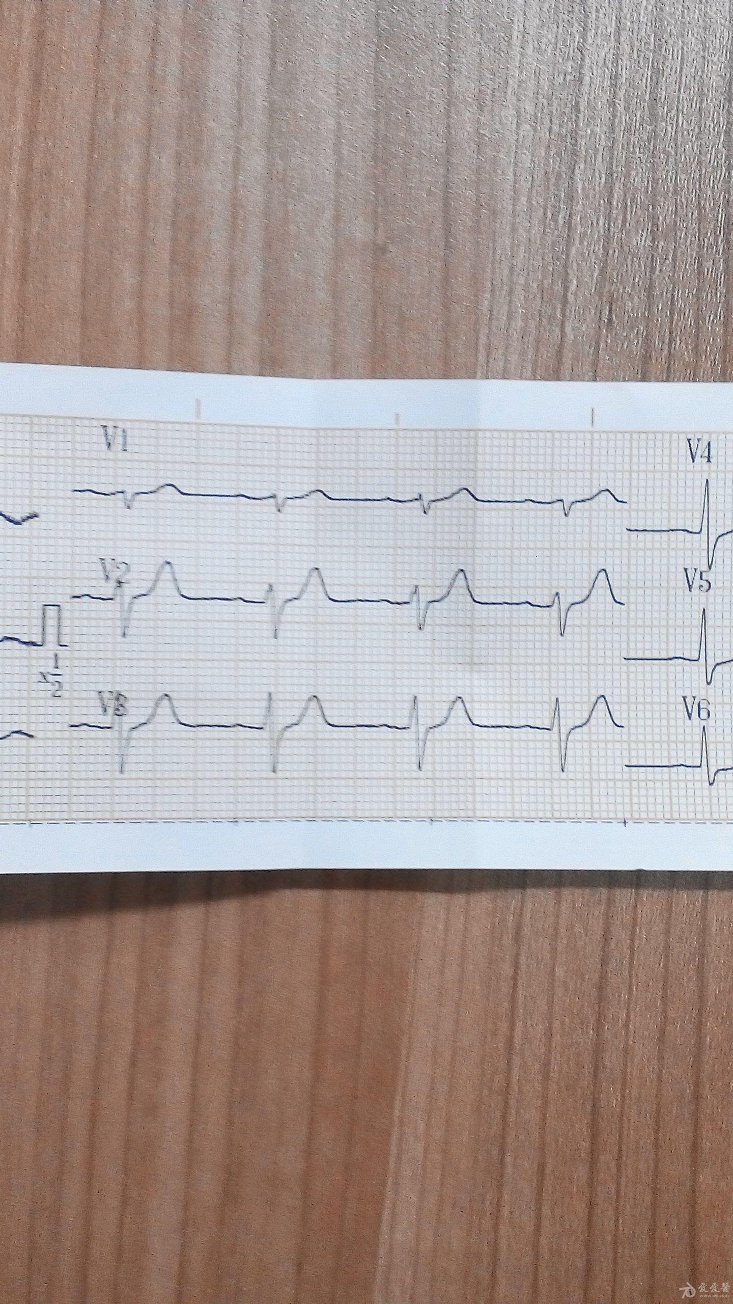 心電圖腦電圖專業討論版 - 愛愛醫醫學論壇