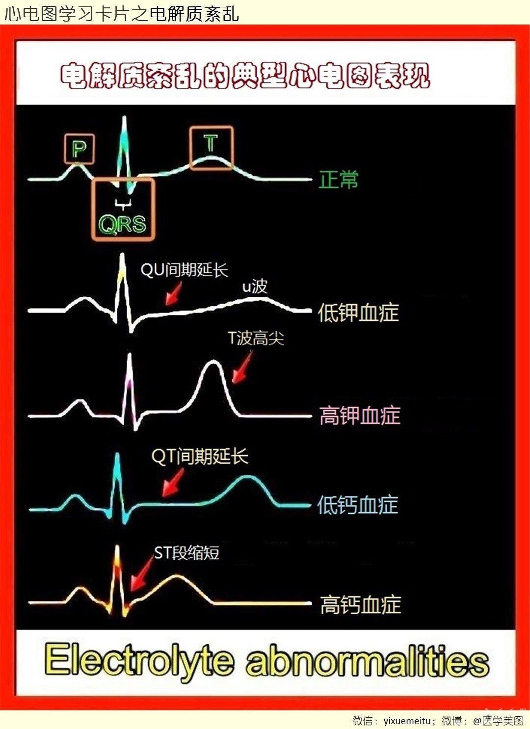 紊乱什么意思图片