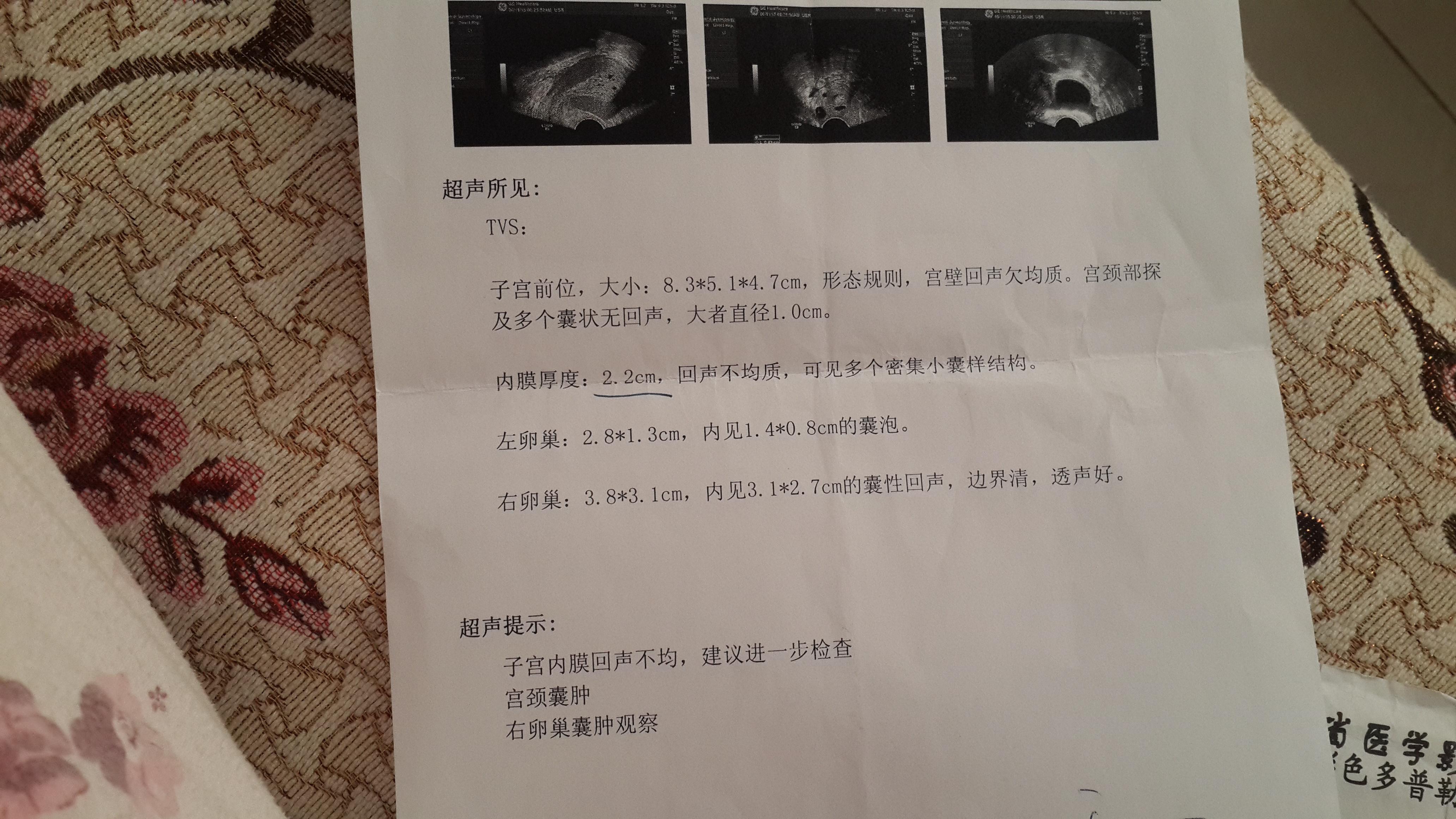 宮頸囊腫需要治療嗎