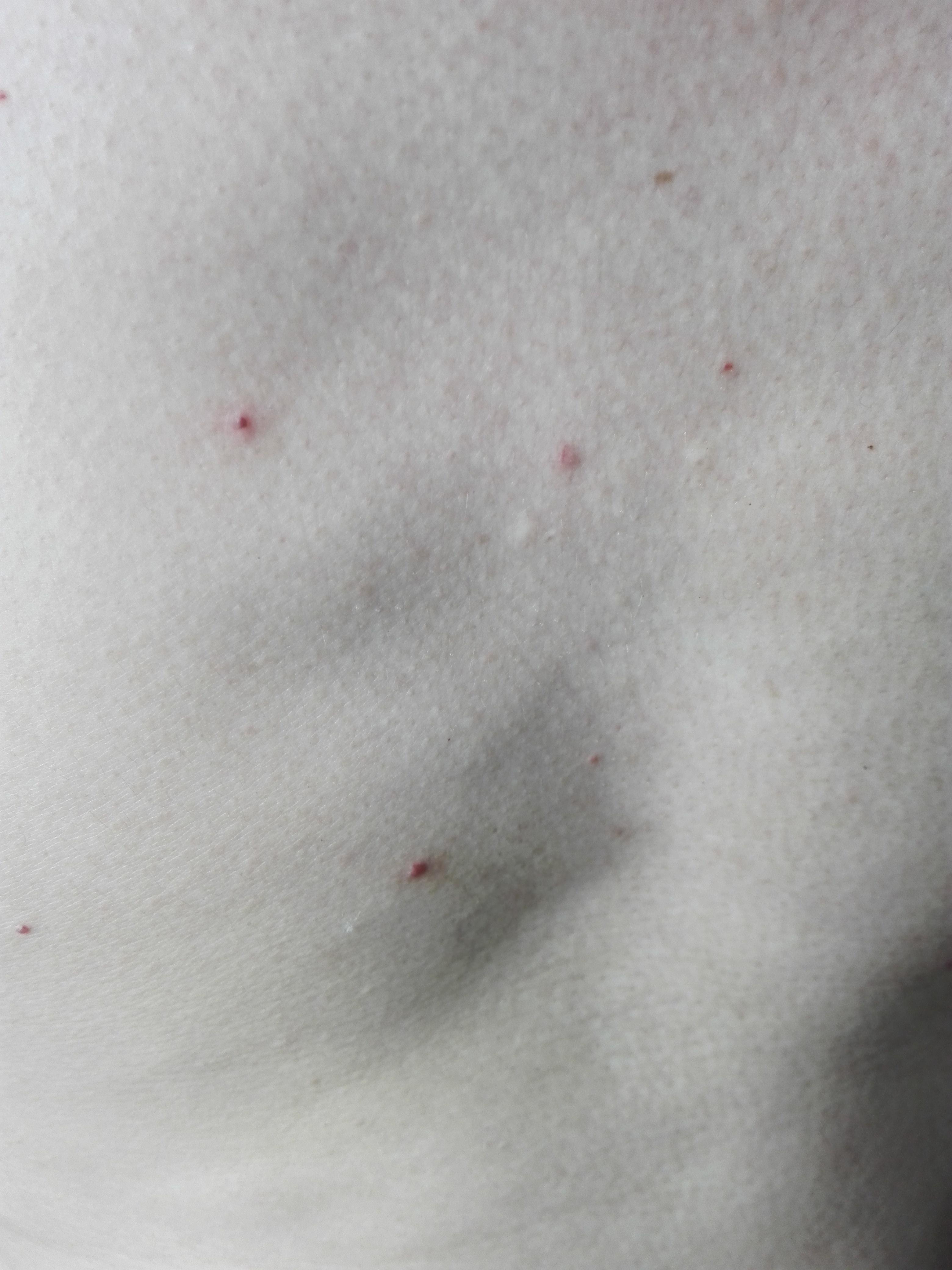 毛发检测多少正常 15062815062817151656a808e9d3cd8a0.jpg