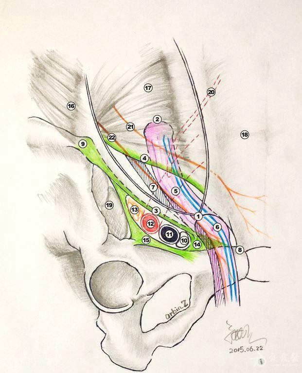 [腹部疝] 【转帖】一图读懂腹股沟疝