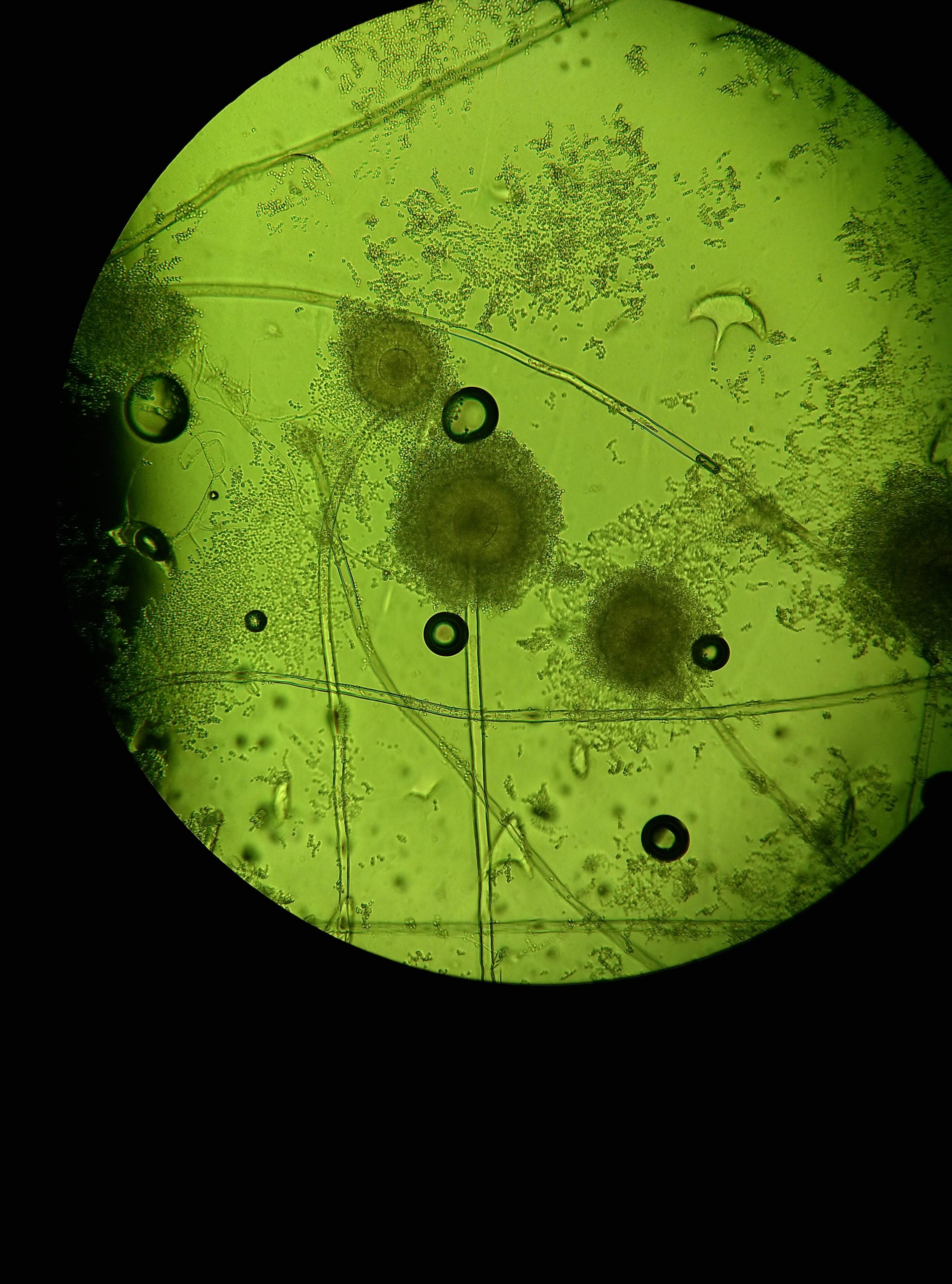 霉菌图片大全显微镜图片