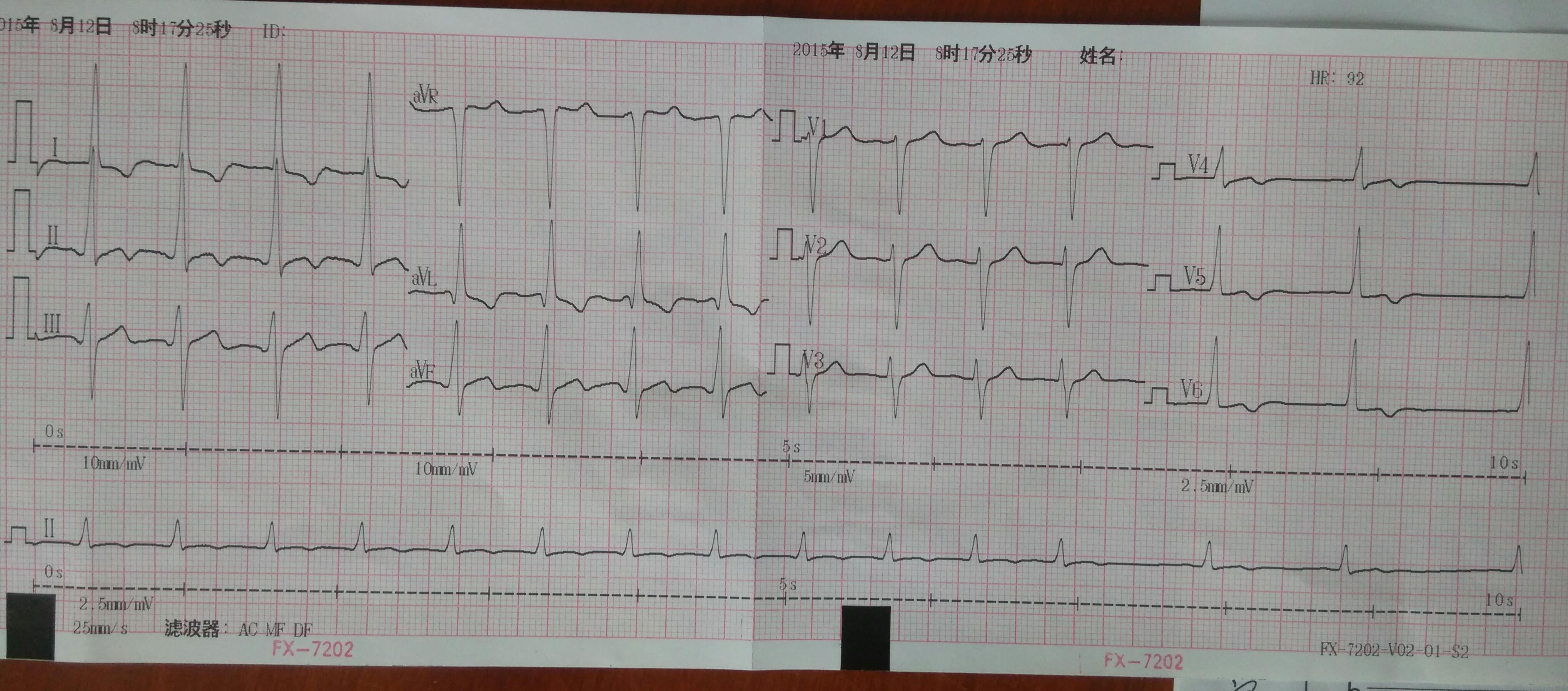 心电图脑电图专业讨论版 - 爱爱医医学论坛