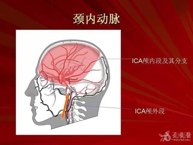 脑血管解剖颈内动脉及其分支