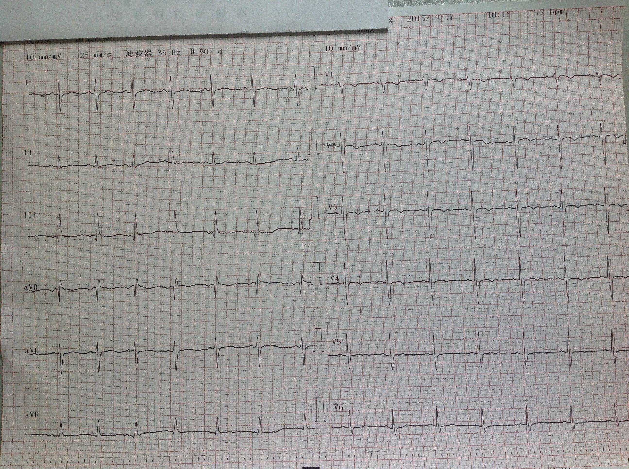 心电图脑电图专业讨论版 - 爱爱医医学论坛