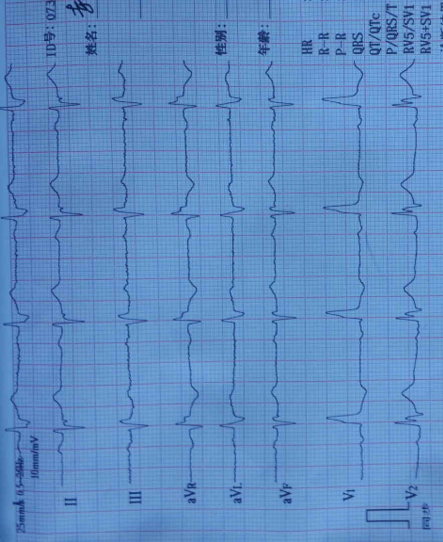 心電圖診斷