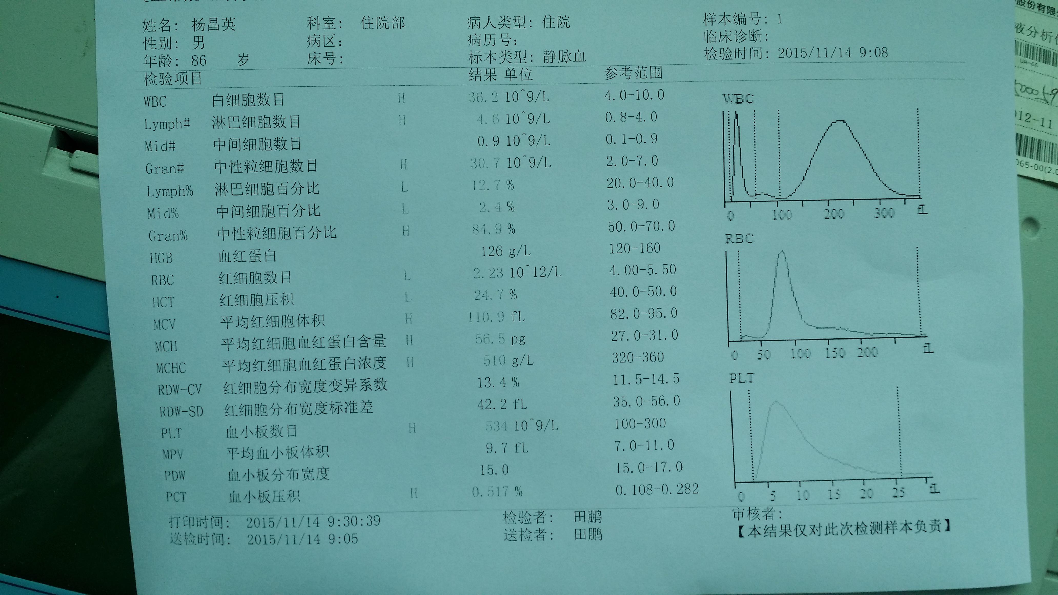 感染病例求教 