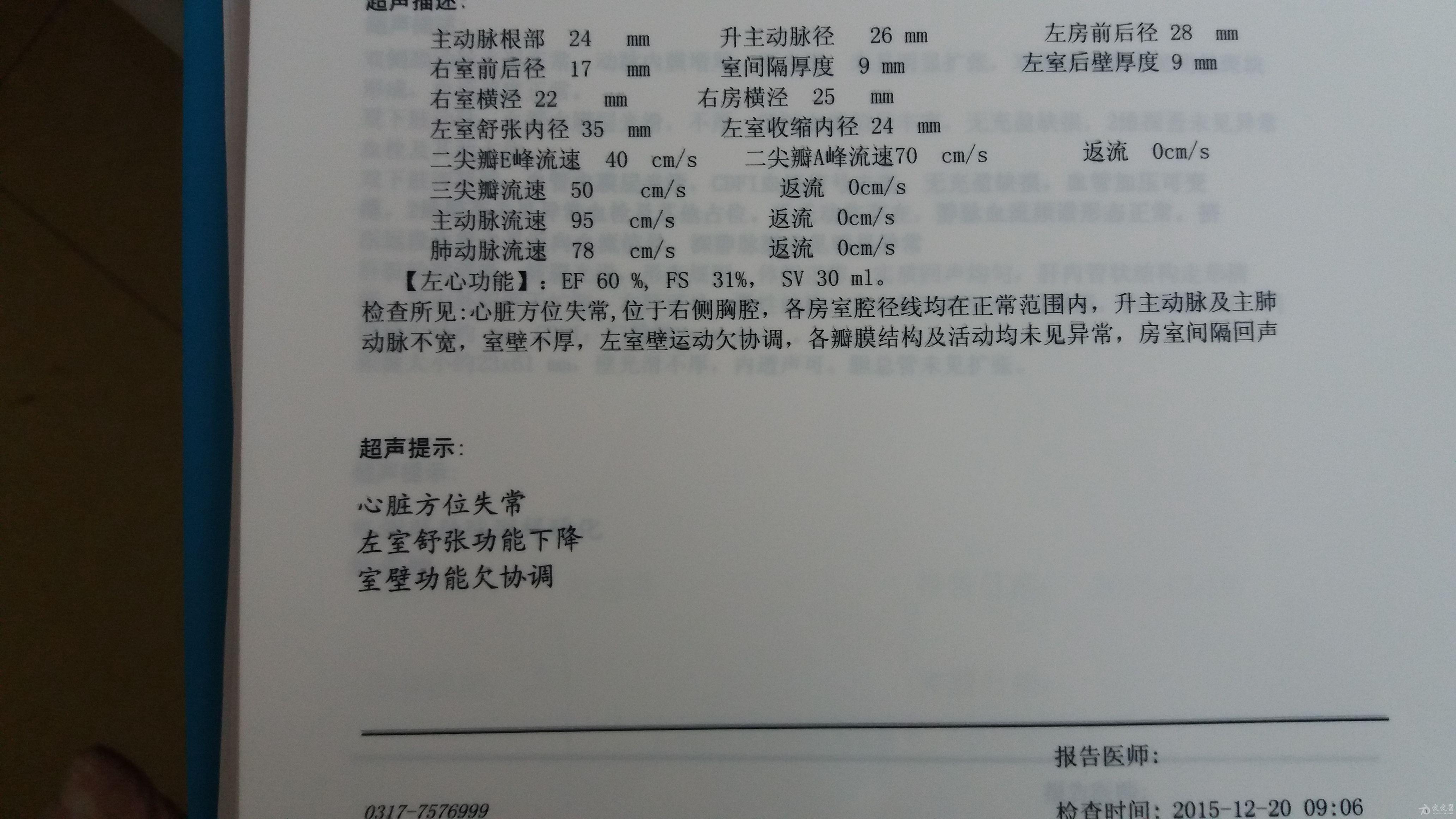 左侧胸腔积液原因待查?