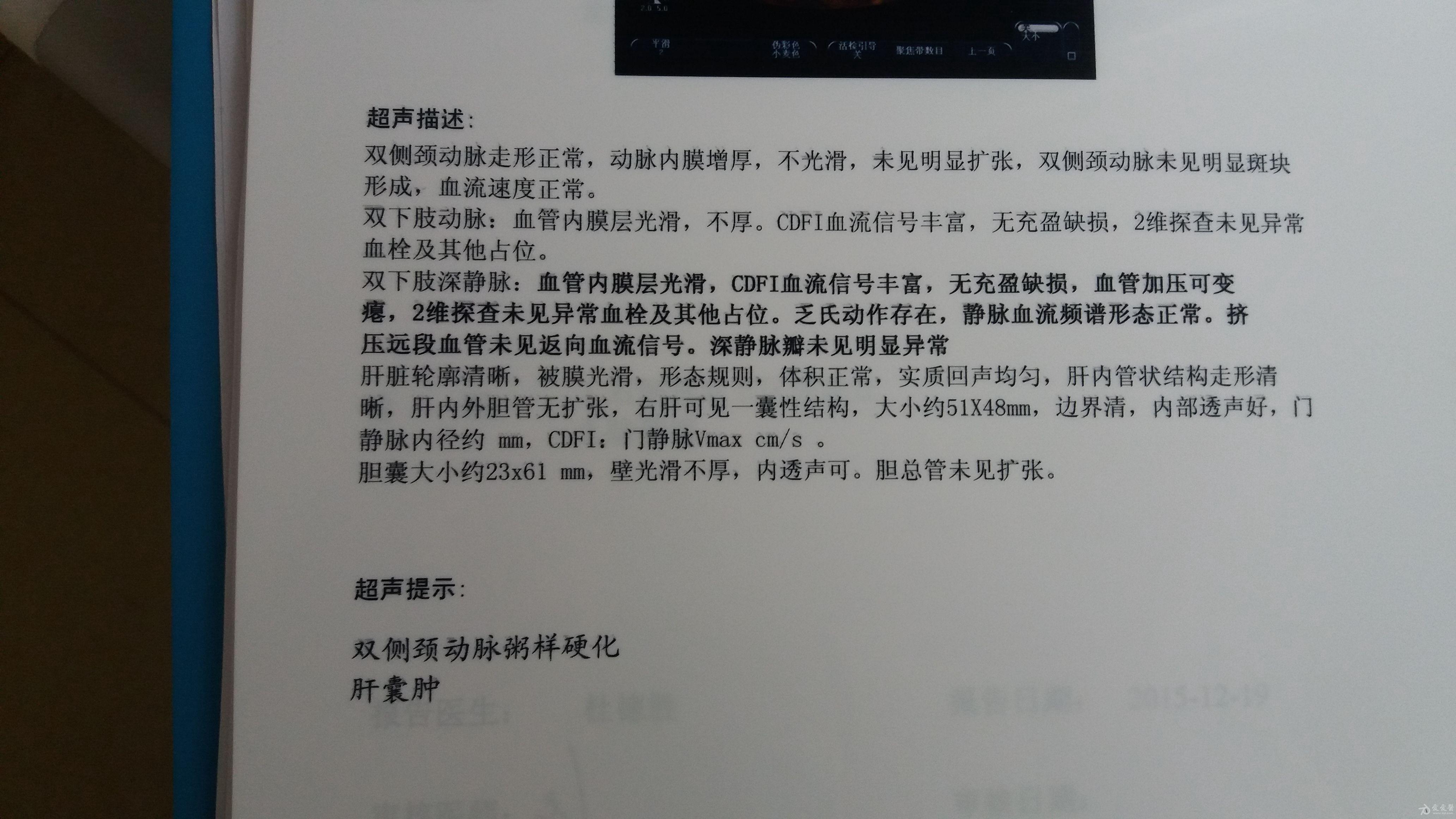 左侧胸腔积液原因待查