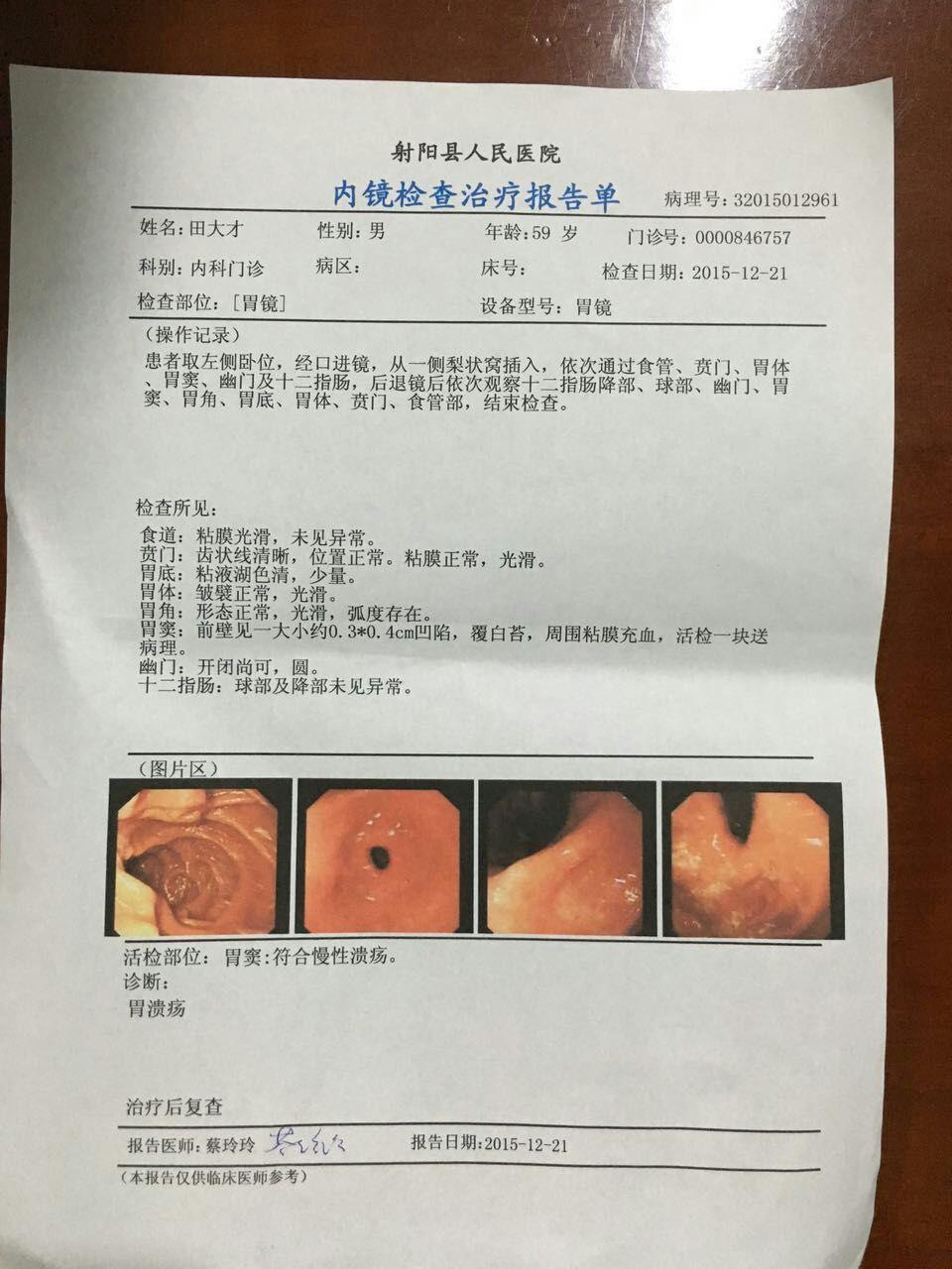 胃镜报告肿瘤图片