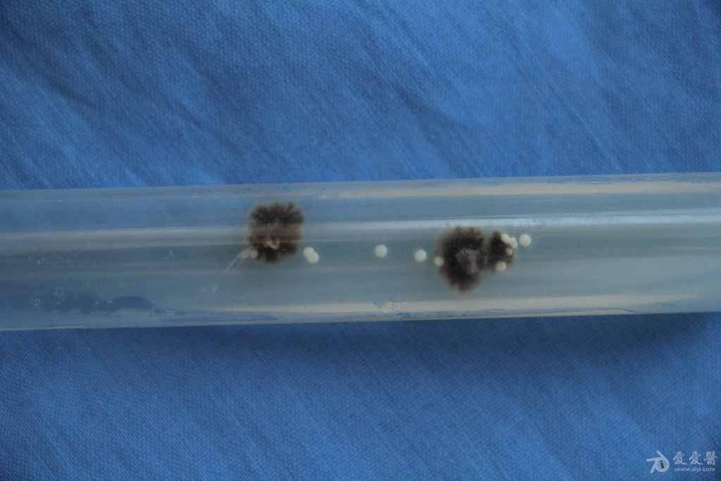 孢子丝菌病试管培养