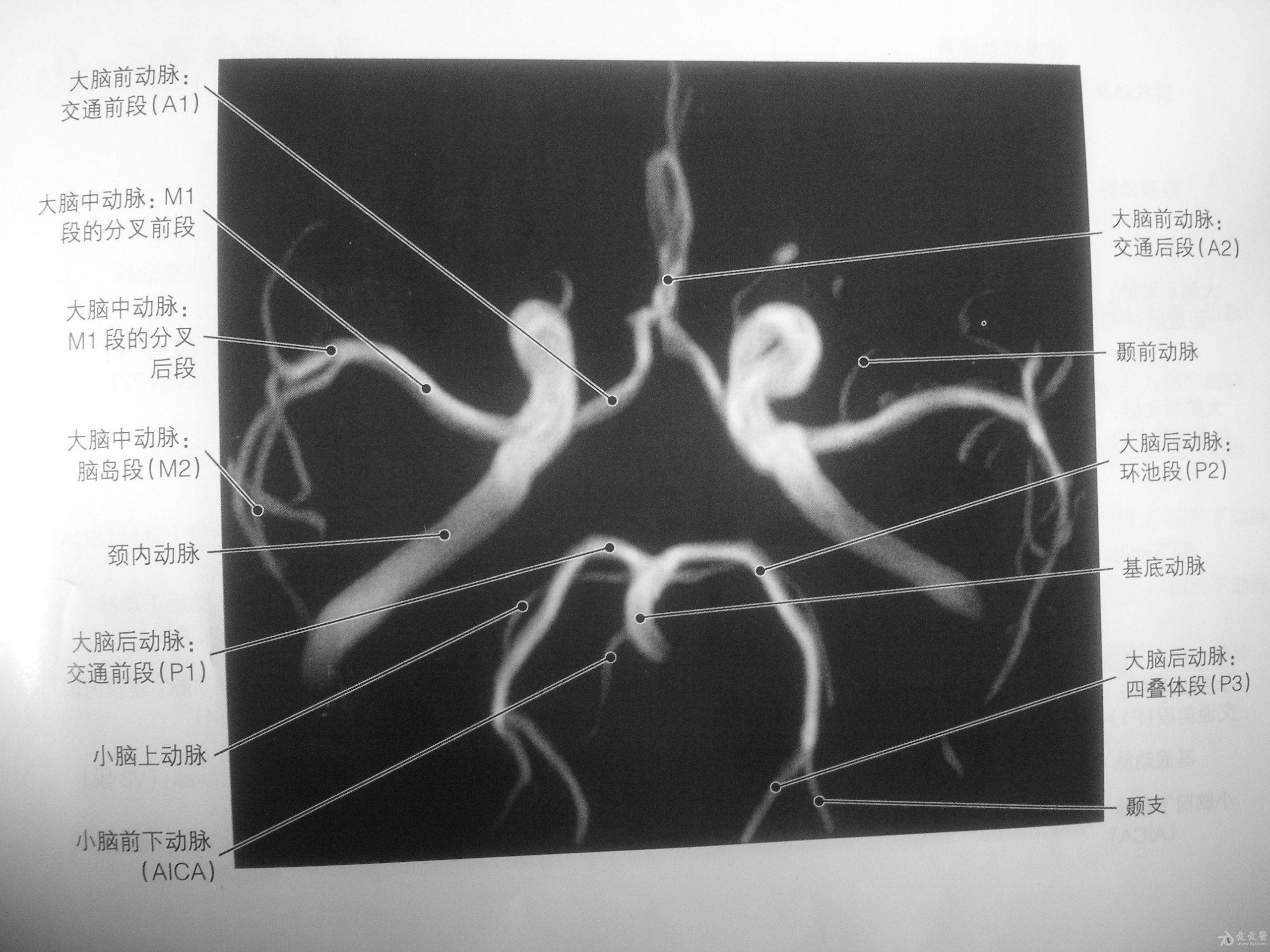 颅内动脉分析 