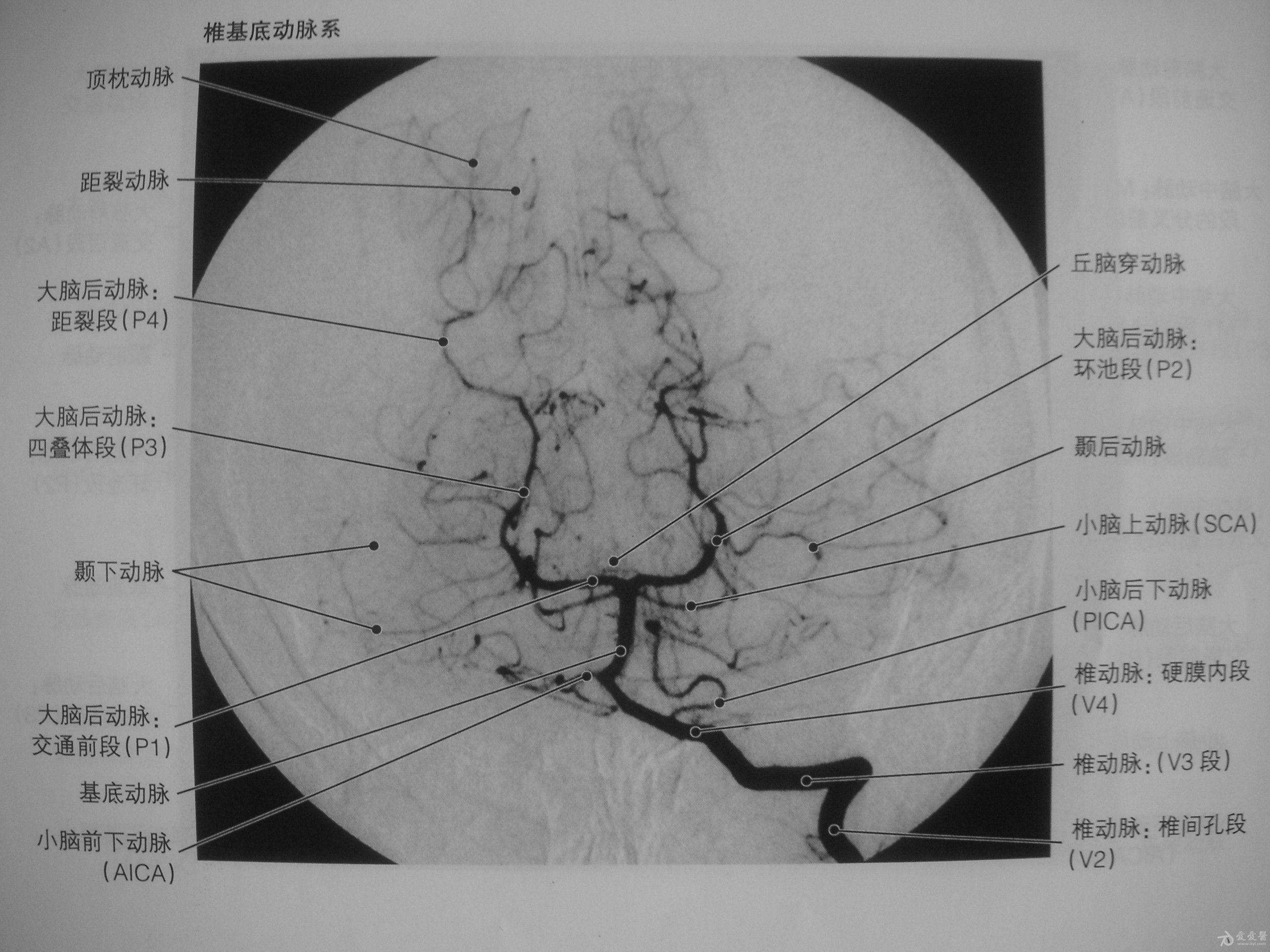 颅内动脉分析 
