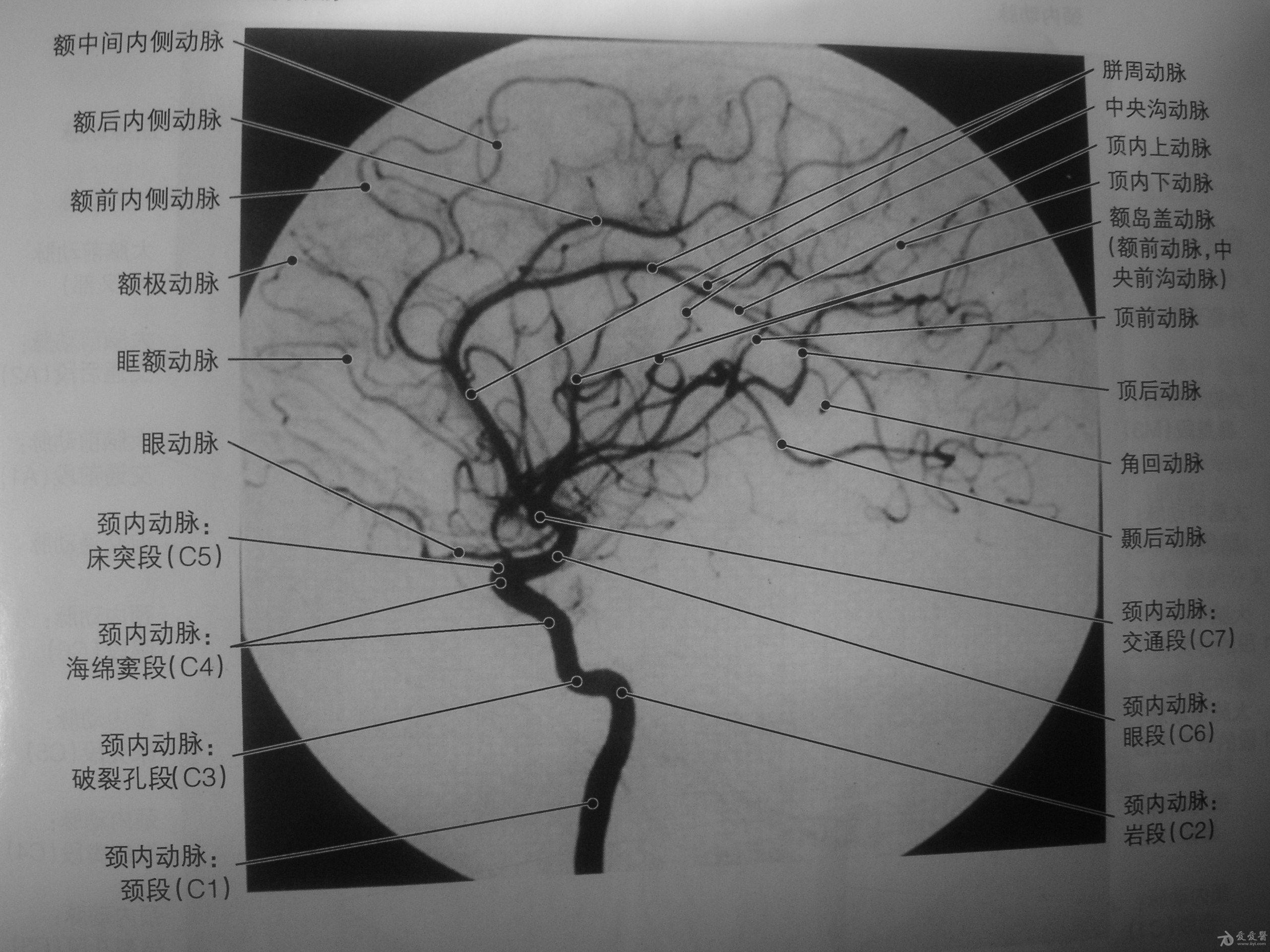 颅内动脉分析