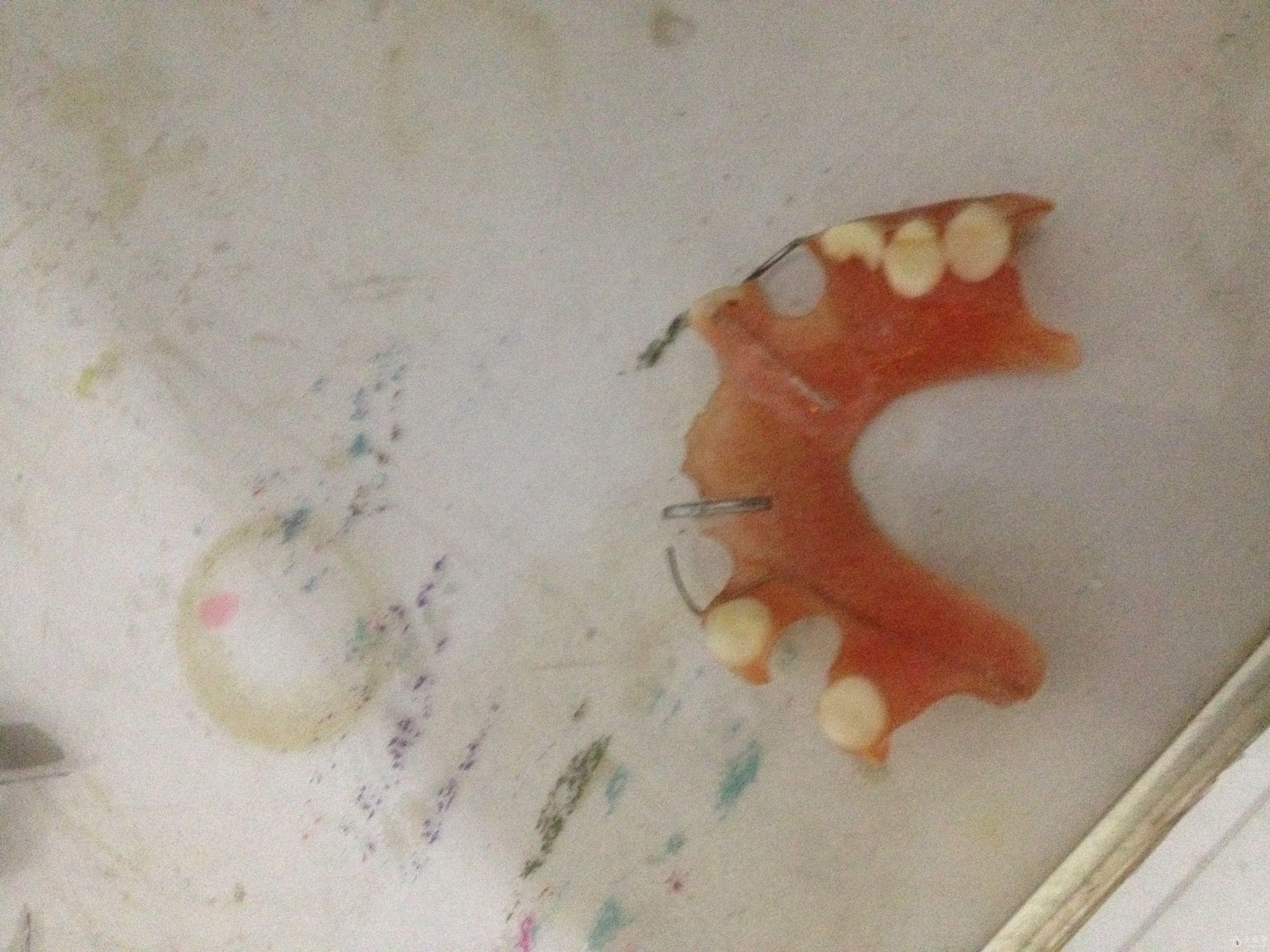 塑料胶托补牙技巧