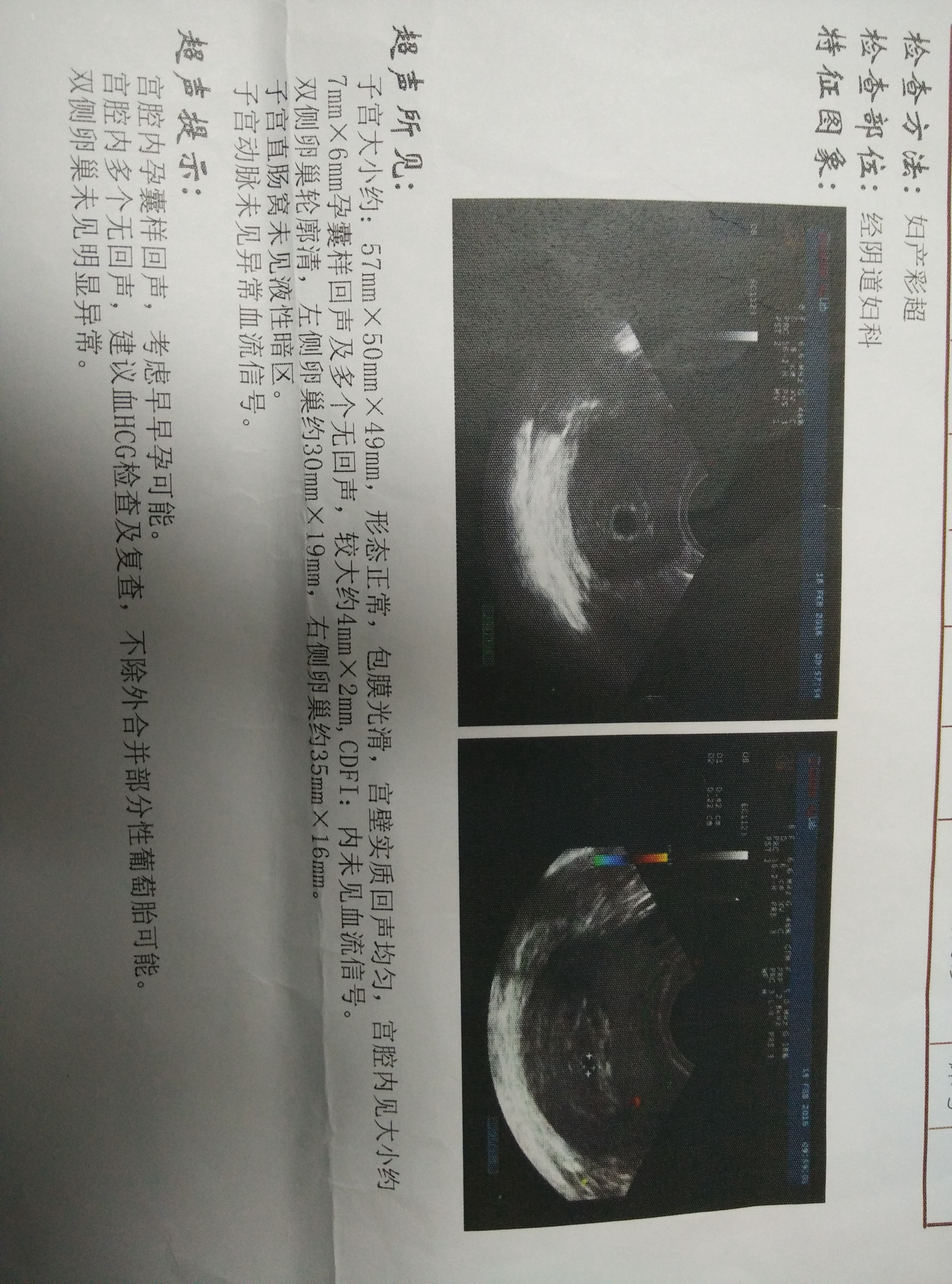 结合hcg葡萄胎可能性是否可以排除