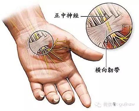 tinel征阳性图片