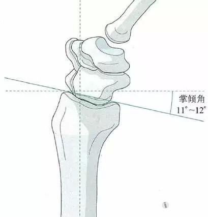 掌倾角与尺偏角示意图图片