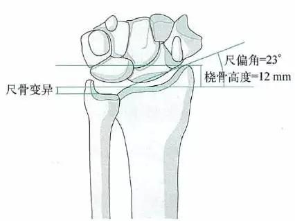 尺桡骨远端的应用解剖 你还记得吗 骨科与显微外科专业讨论版 爱爱医医学论坛