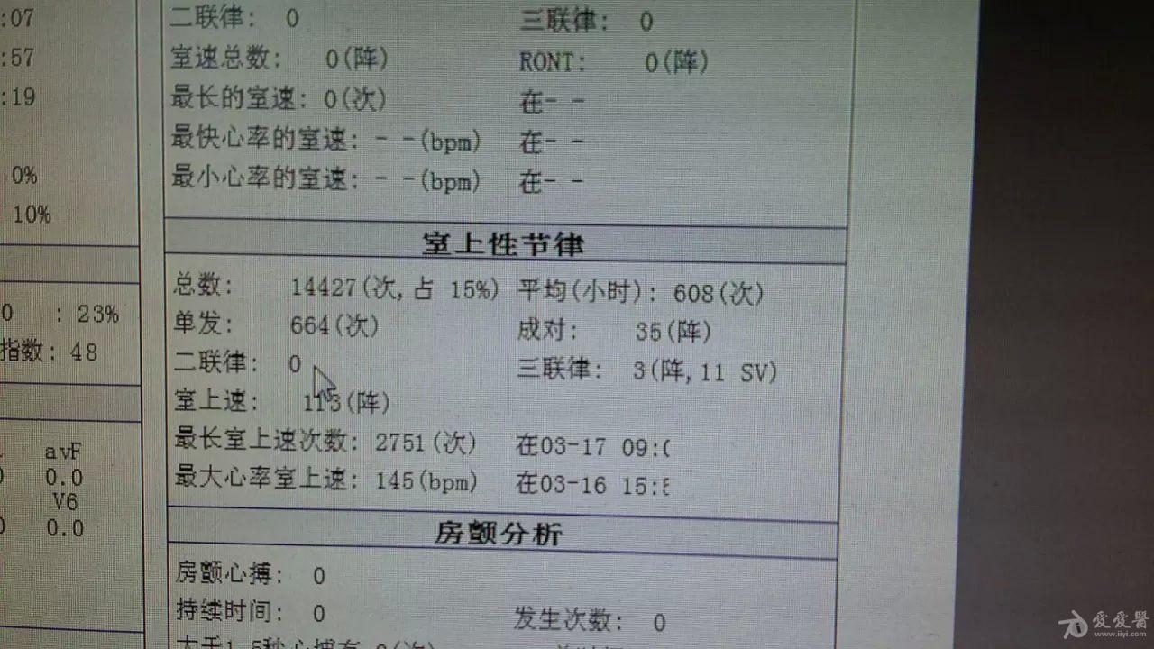 室上速 - 心電圖腦電圖專業討論版 - 愛愛醫醫學論壇