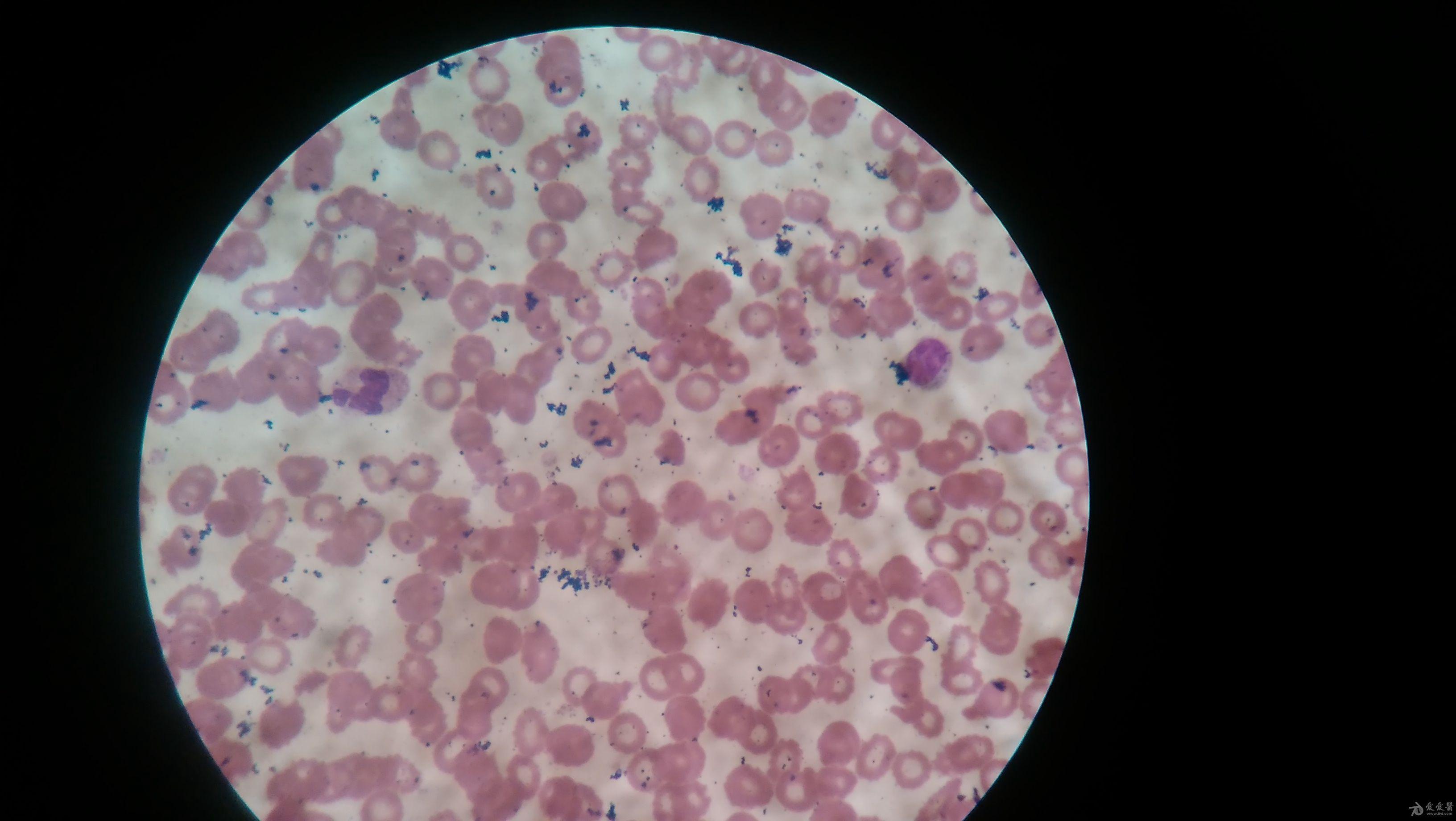 血涂片各种细胞的图片图片