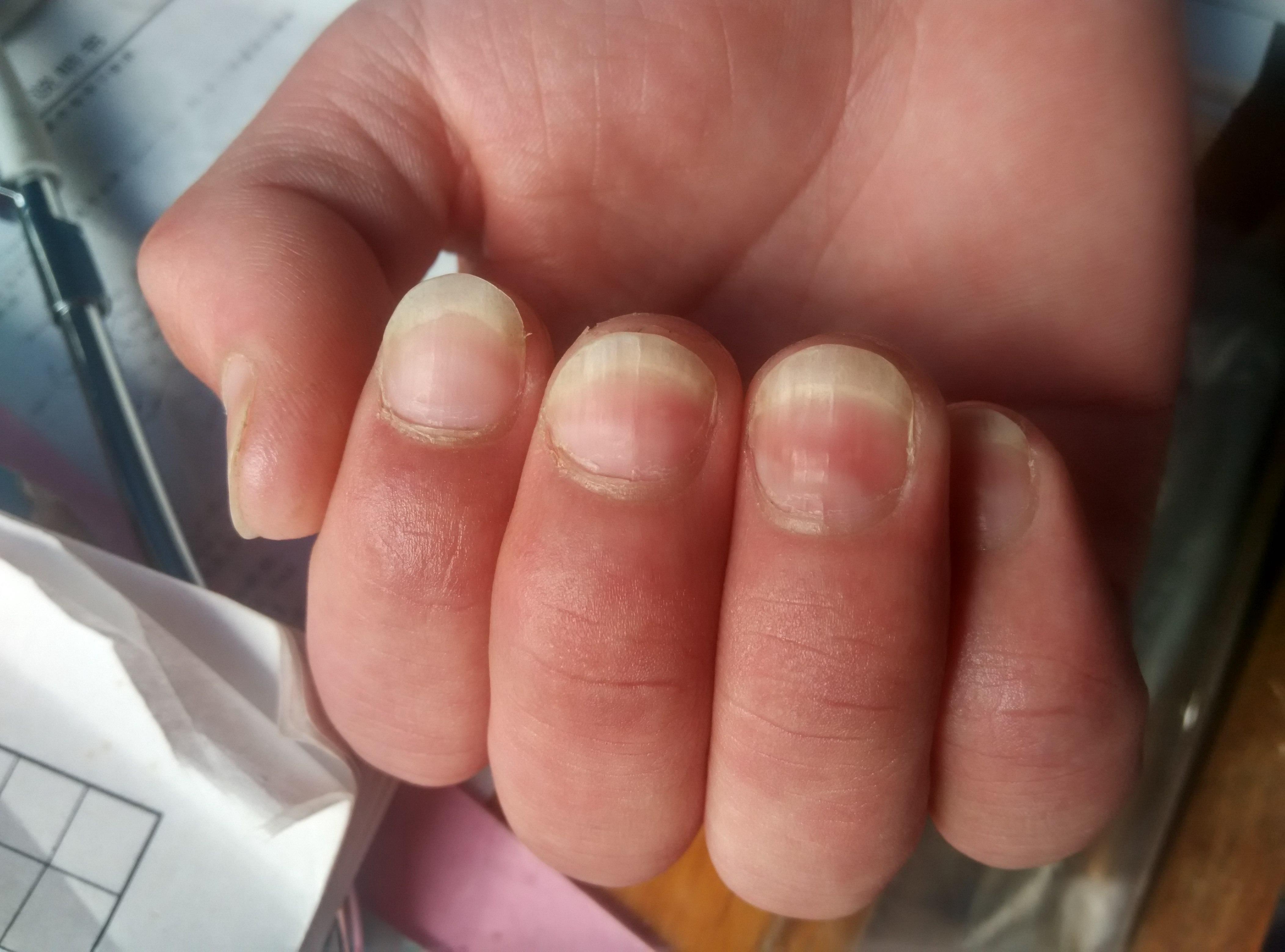 手指甲是什么甲