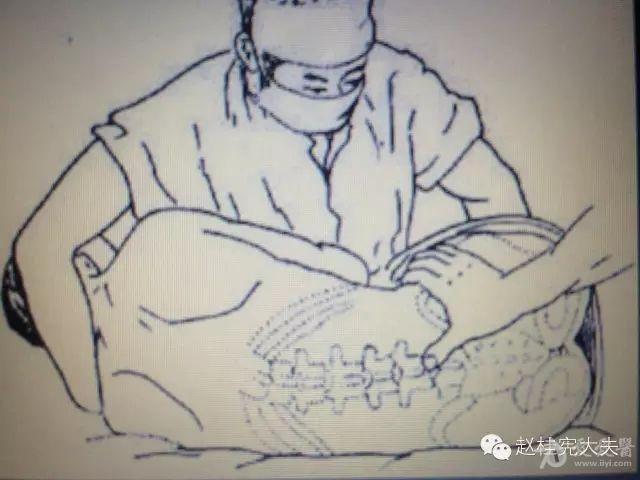 如何做回漂亮的腰椎穿刺术?