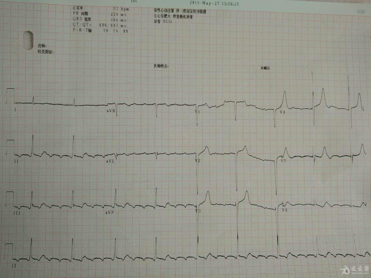 请教老师们心房扑动41传导对吧
