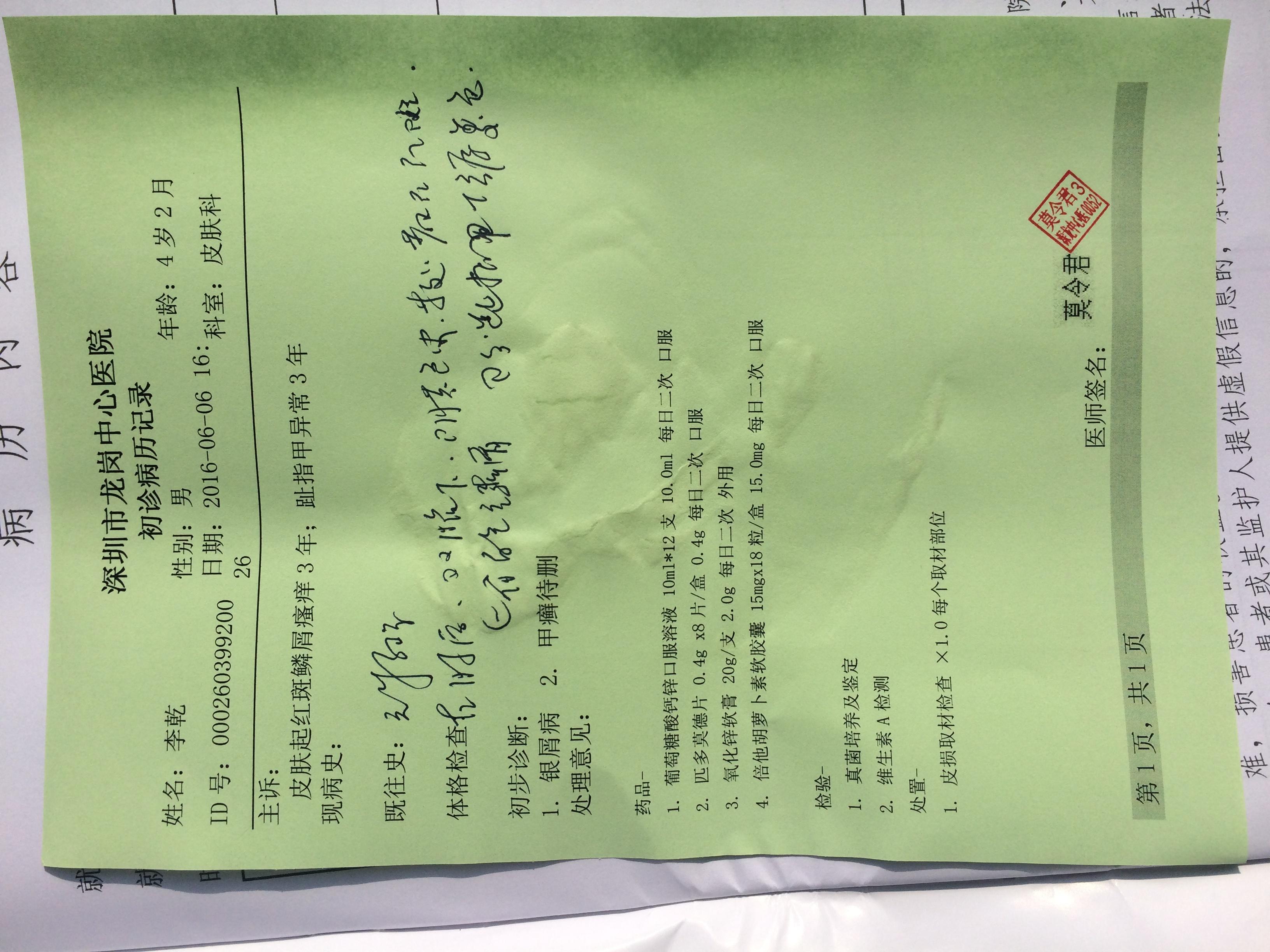 银屑病还是真菌感染已经初步诊断结果