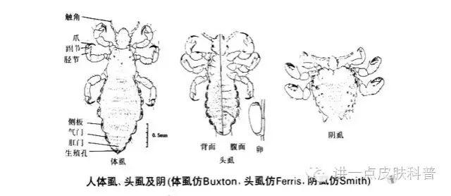 阴虱和头虱有什么区别图片