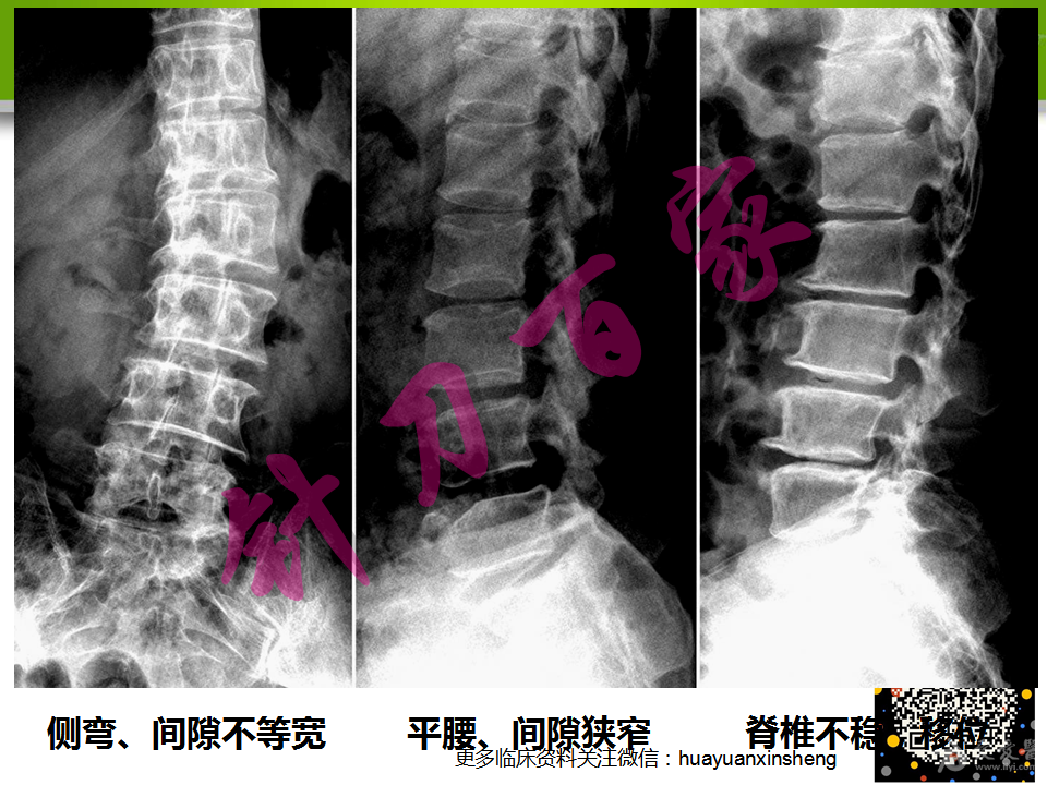 160615102351vhk4ohk6iu33hd2d.png