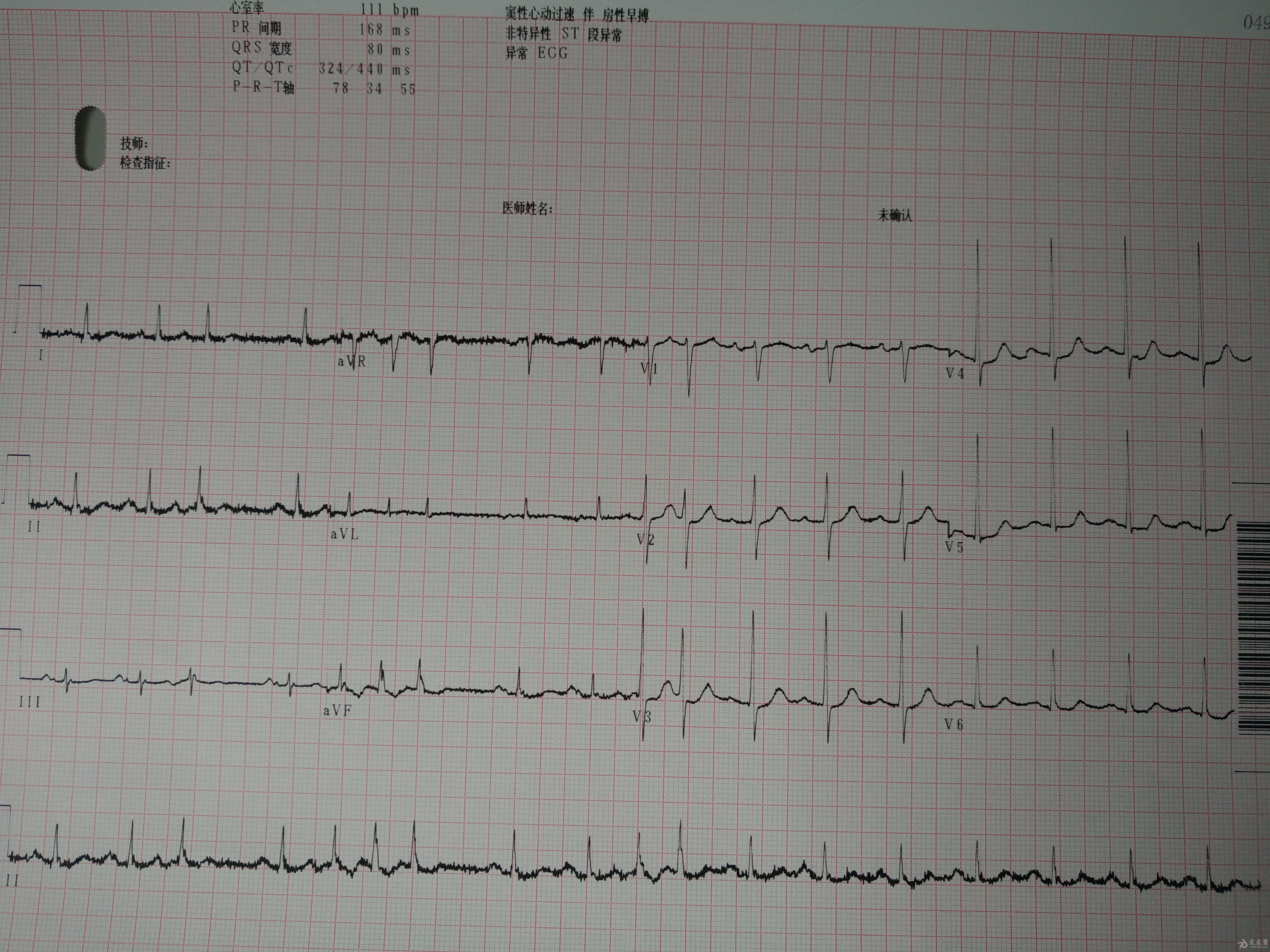 心电图脑电图专业讨论版 - 爱爱医医学论坛