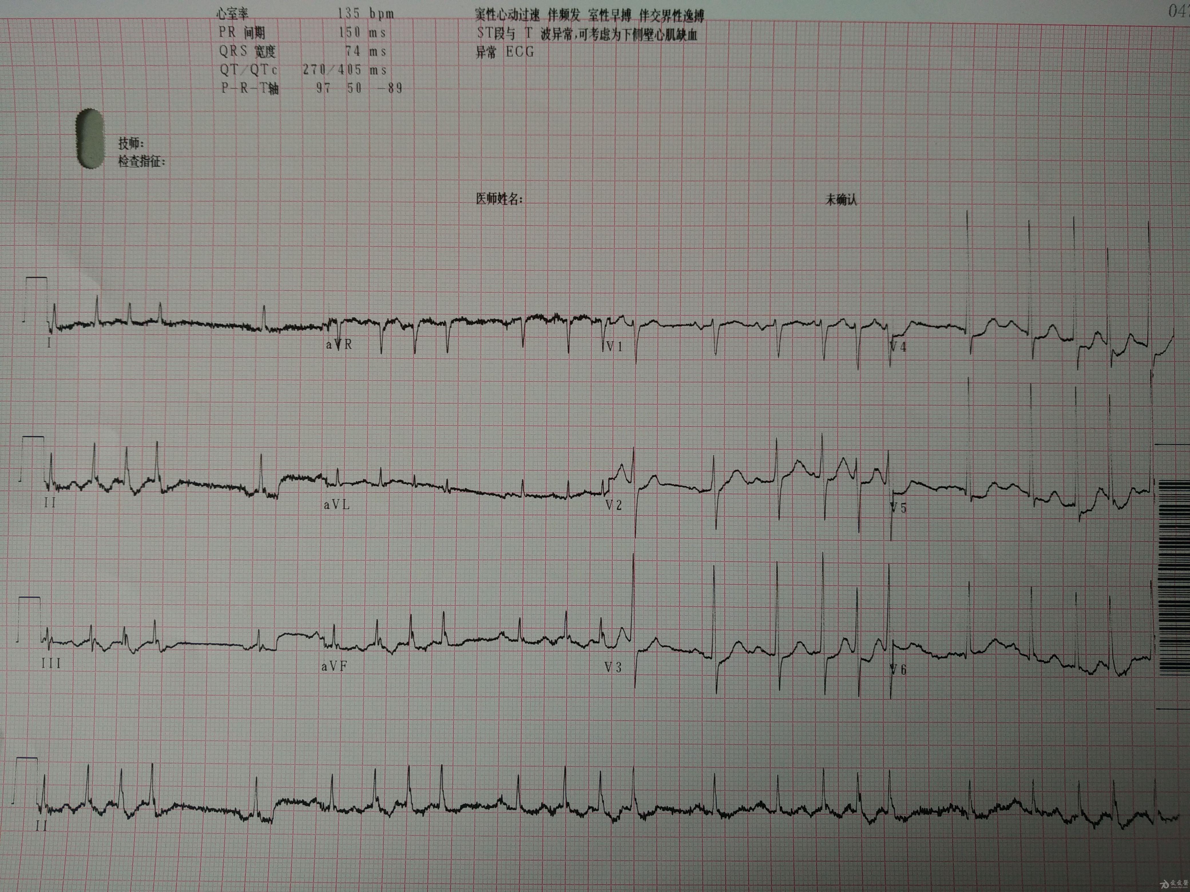 心電圖腦電圖專業討論版 - 愛愛醫醫學論壇
