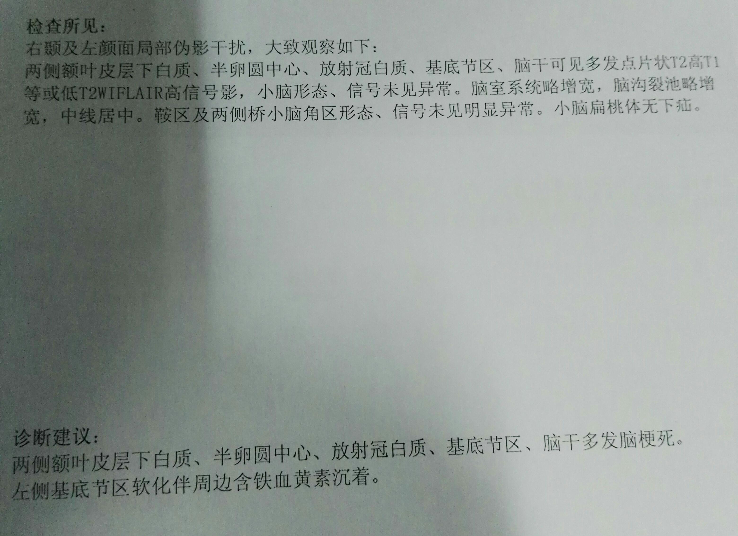 核磁报含铁血黄素沉着一例.