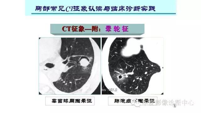 佳节赏月也来聊聊新月形新月征晕轮征