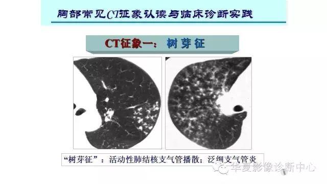 佳节赏月也来聊聊新月形新月征晕轮征