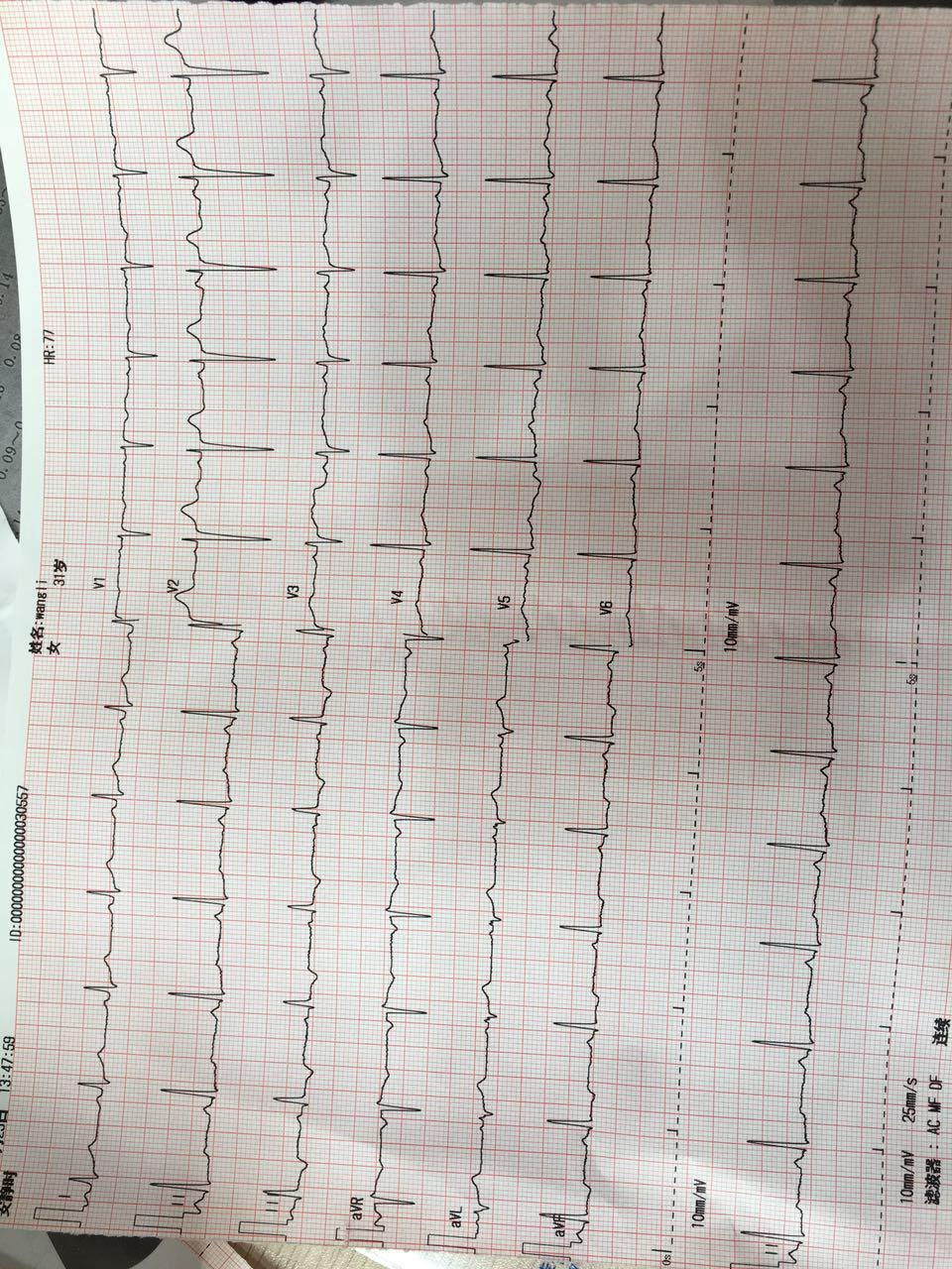 心电图脑电图专业讨论版 - 爱爱医医学论坛