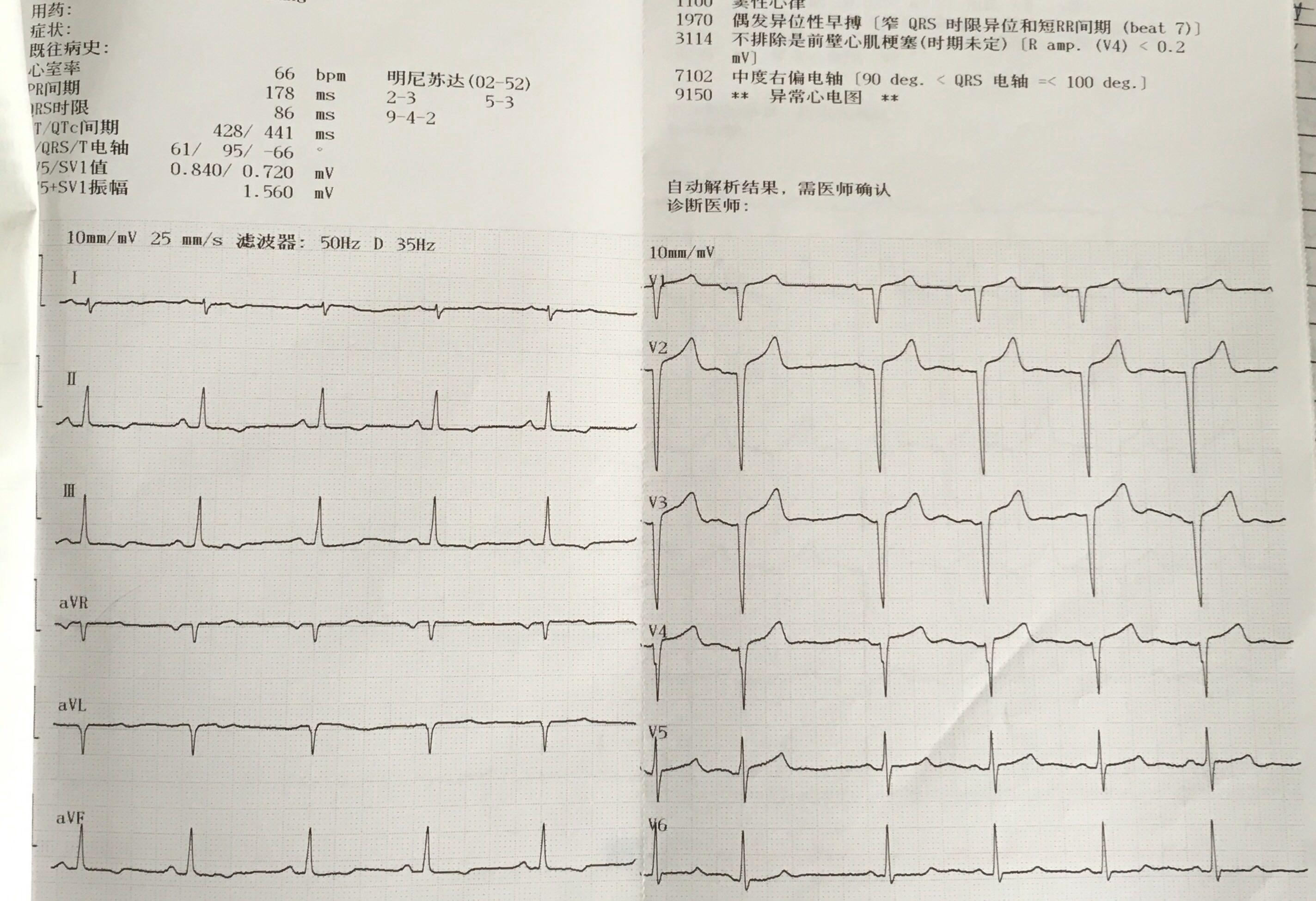 冠心病检查结果图片