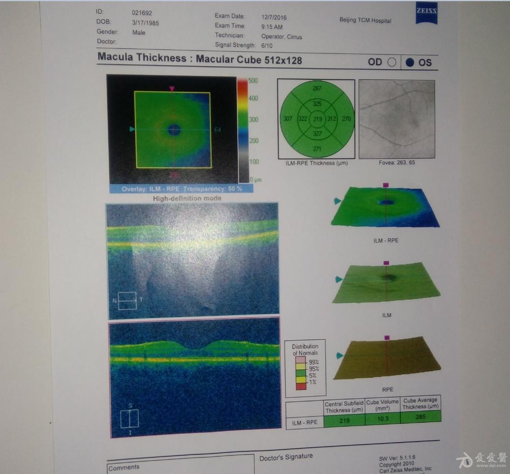 近一个月眼睛不舒服做了oct检查但是看不懂请大家帮帮忙