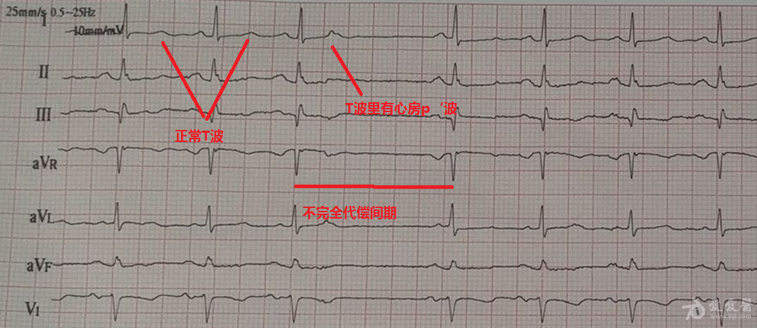 心电图脑电图专业讨论版 