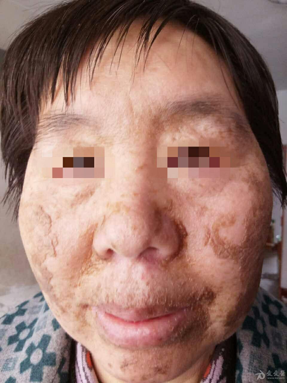 有奖猜图,积分大派送——131皮肤垢着病