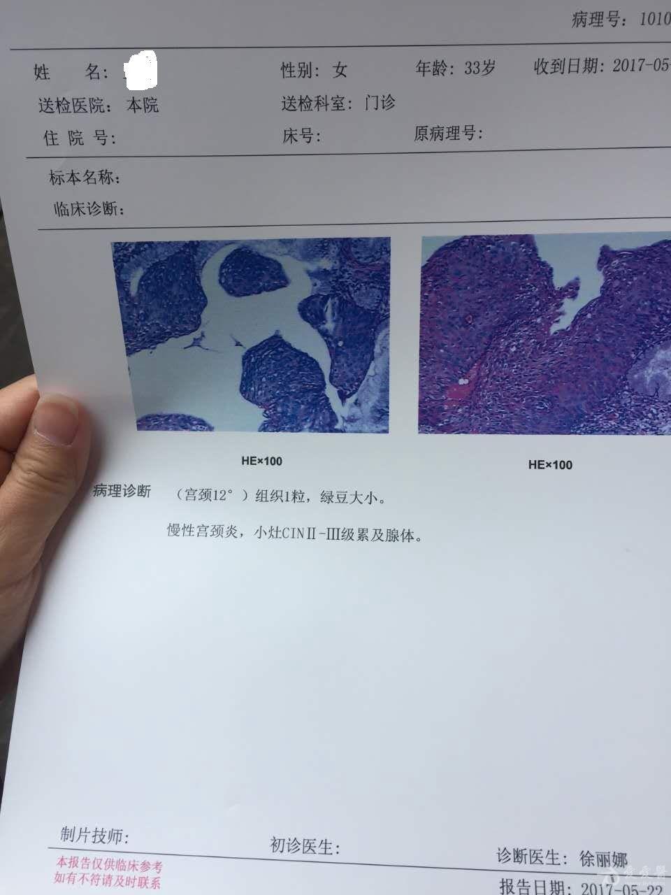 cin2,3级累及腺体是原位癌吗?最合适的治疗方法是什么?