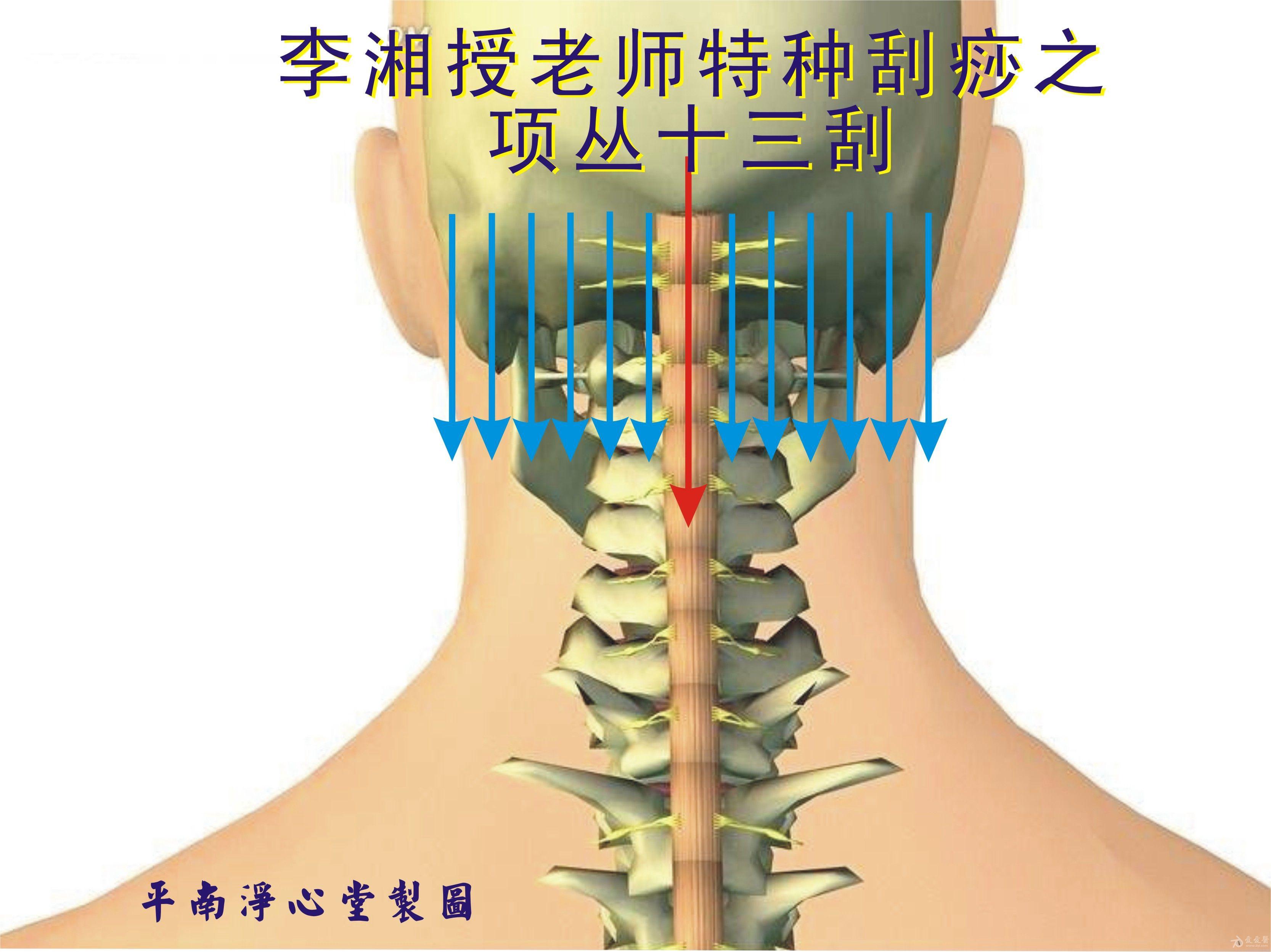 八字疗法在颈椎病中的运用