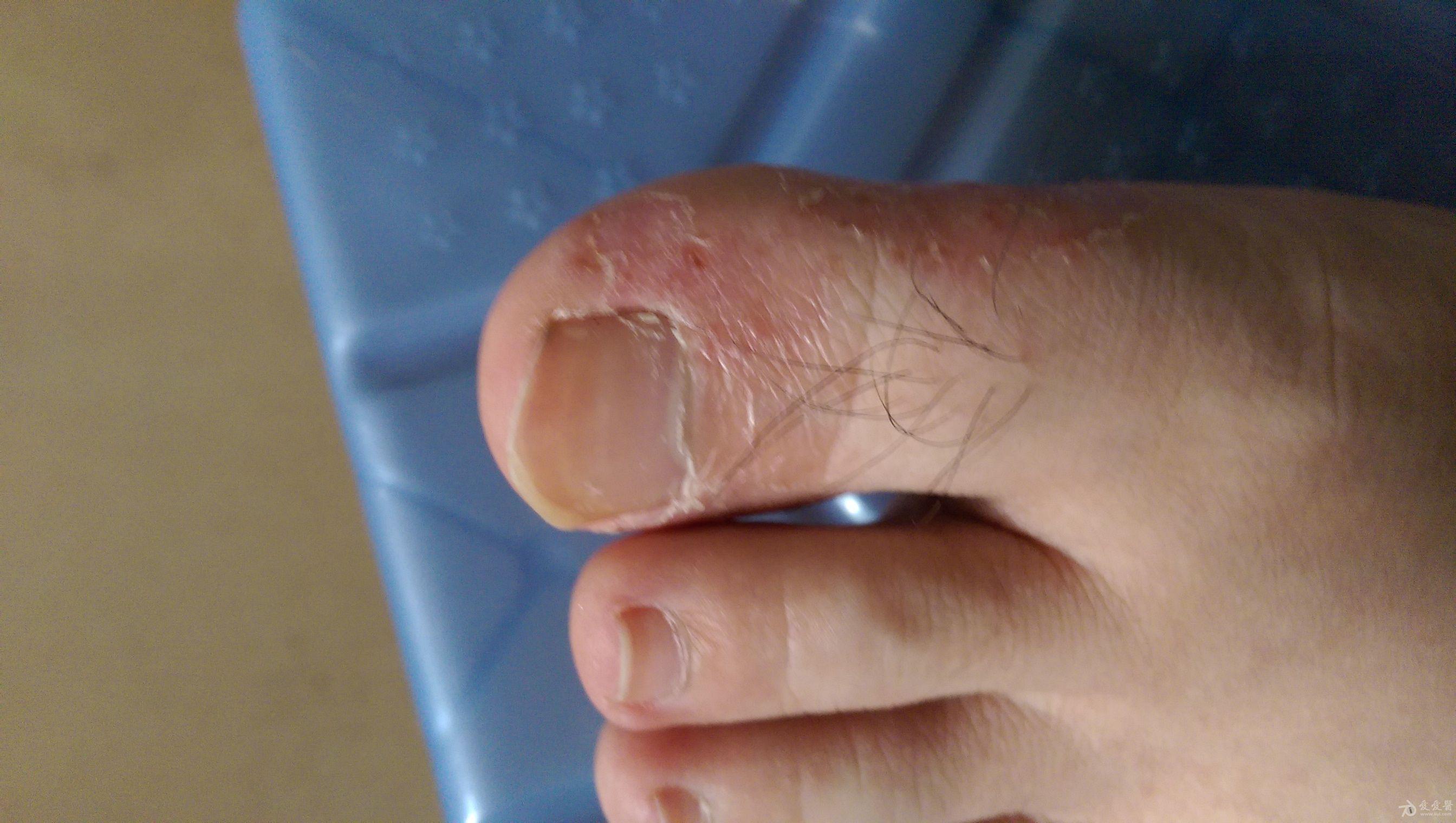 求教各位老师这个是什么病