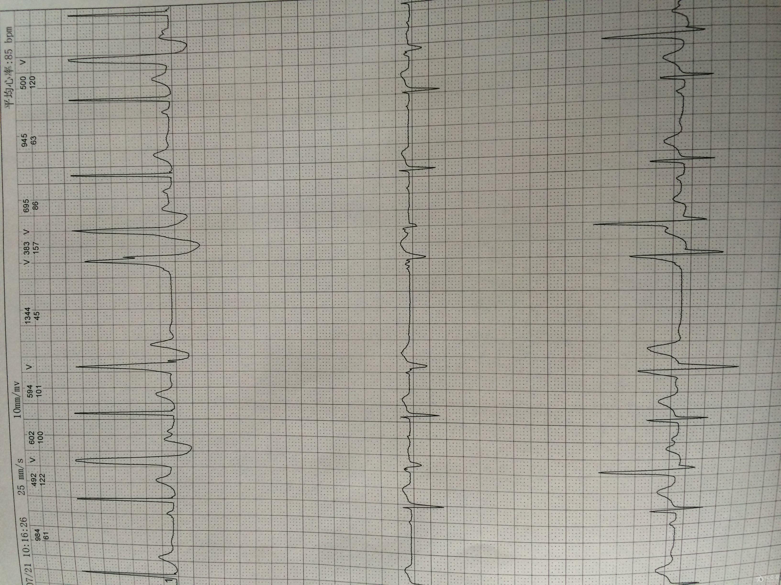 不吝賜教 - 心電圖腦電圖專業討論版 - 愛愛醫醫學論壇