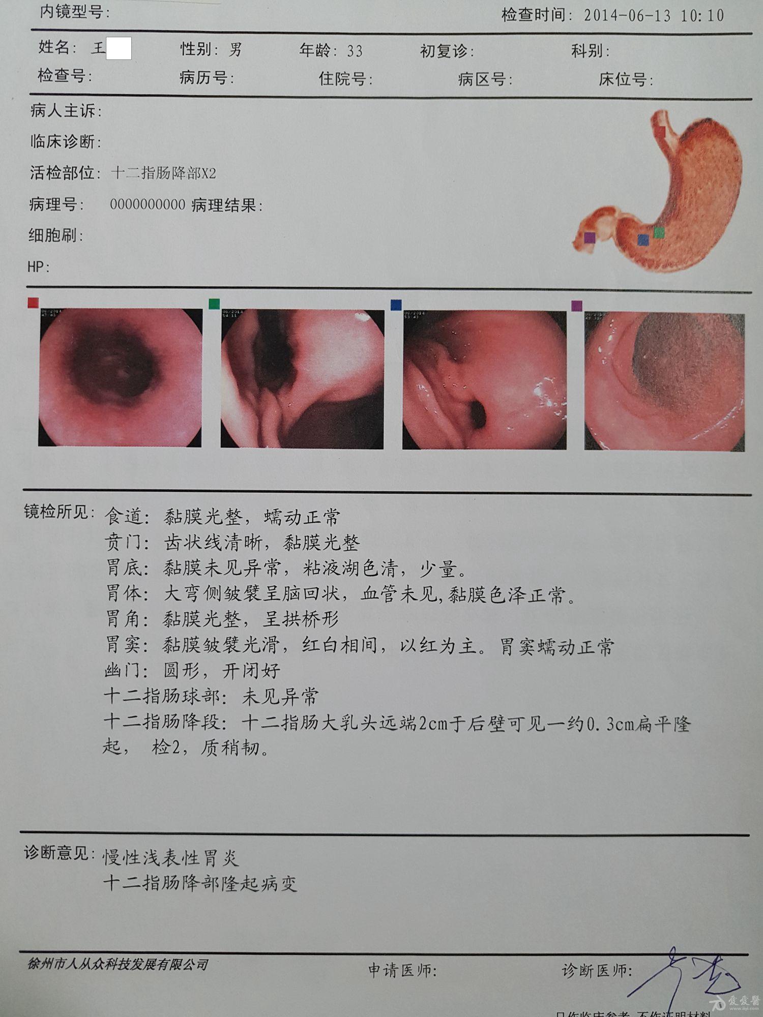 胃穿孔x光图片,胃穿孔立位腹平片图片,胃穿孔图片检查图片_大山谷图库