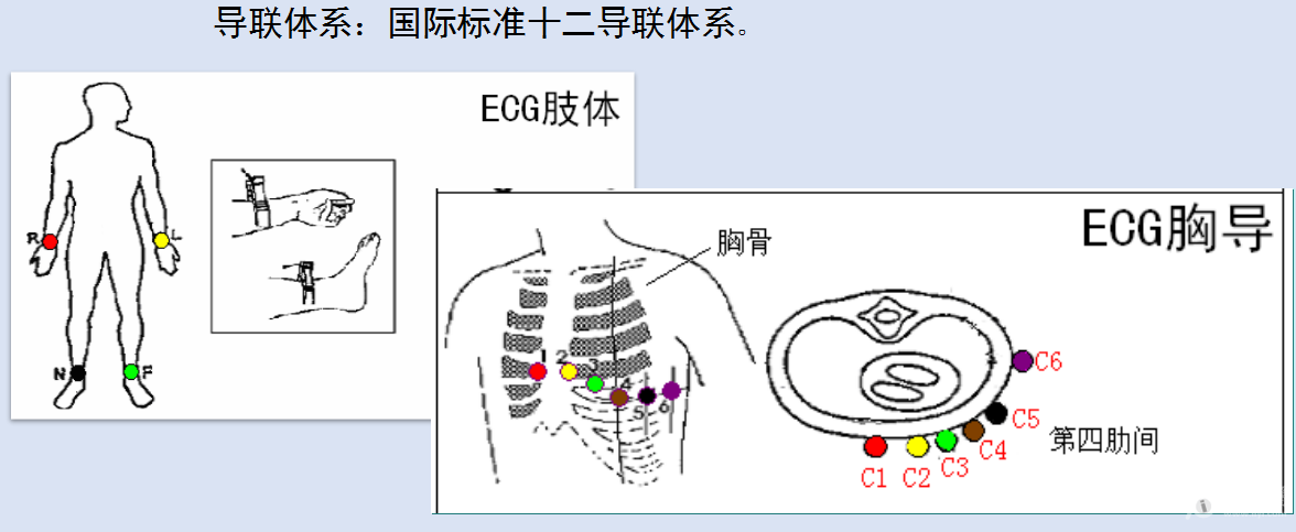 属于两个完全不同的导联体系,胸导联的单极与心电向量导联的电阻抗肯