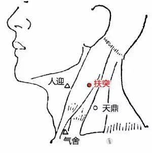 针灸治疗五官科疾病之慢性咽炎